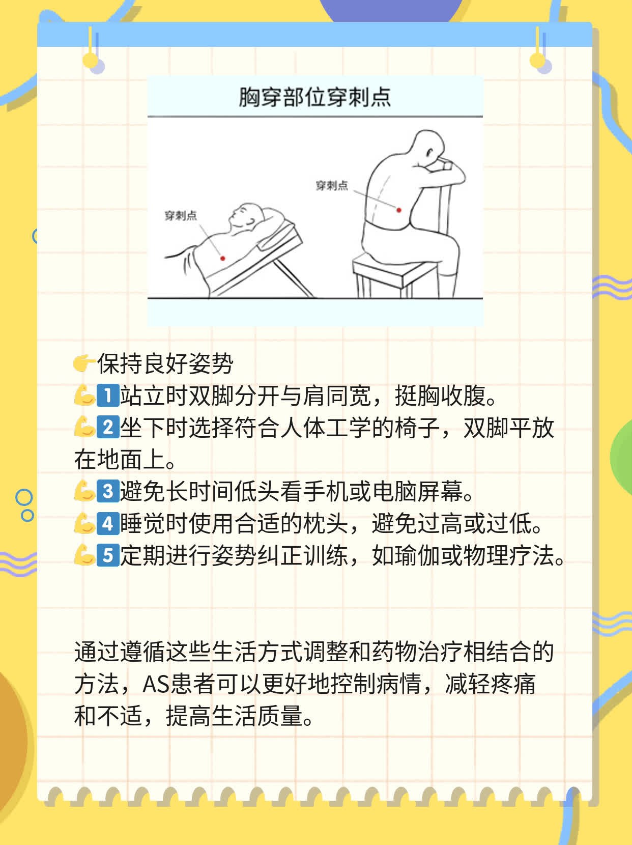 AS治疗必备：强直性脊柱炎用药指南