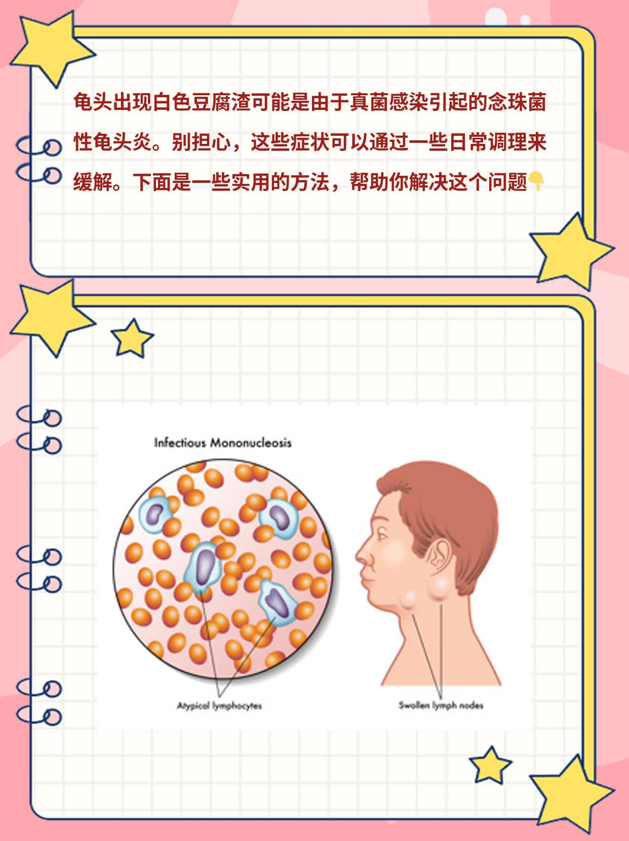 龟头有白渣，原因揭秘！