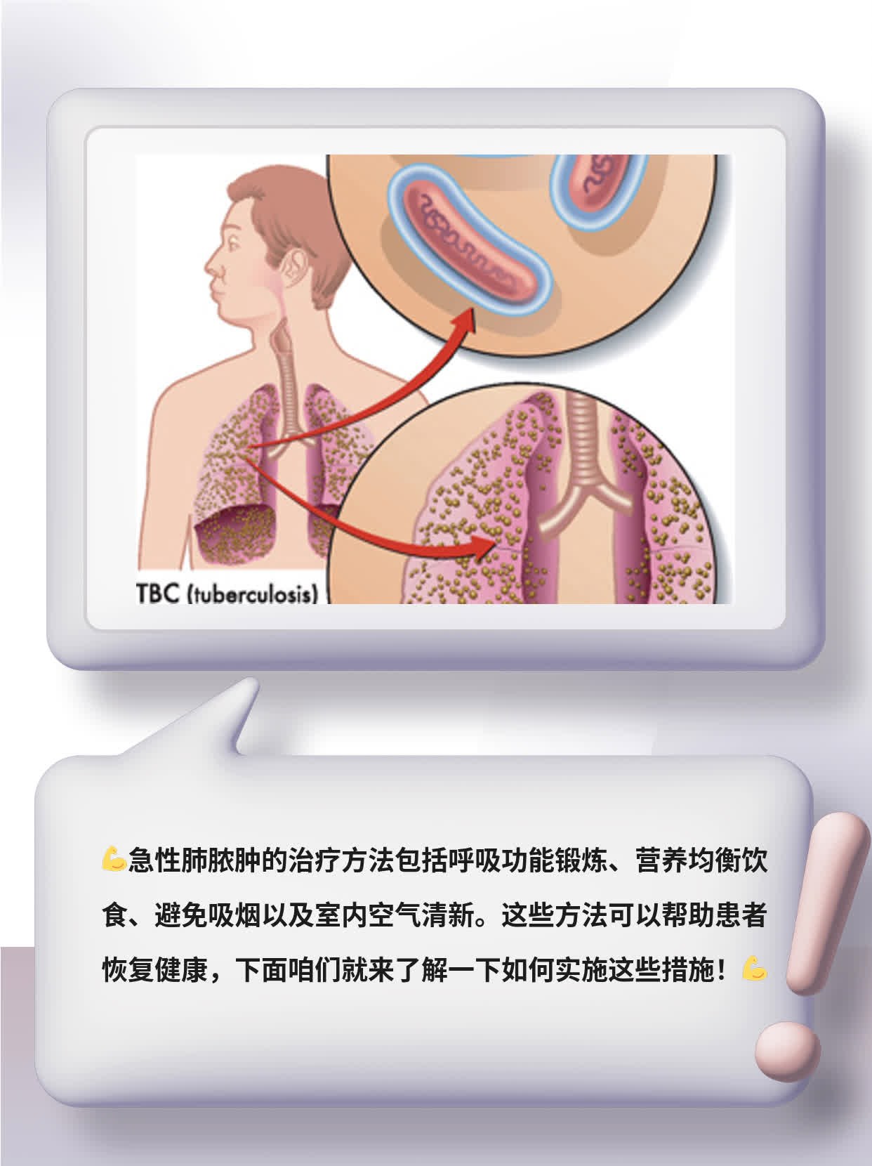 「经验分享」急性肺脓肿的治疗方法一览