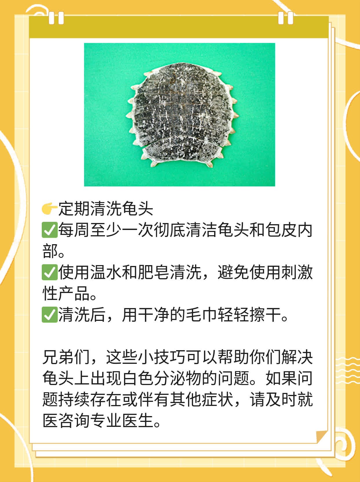 龟头上白渣，原因探秘