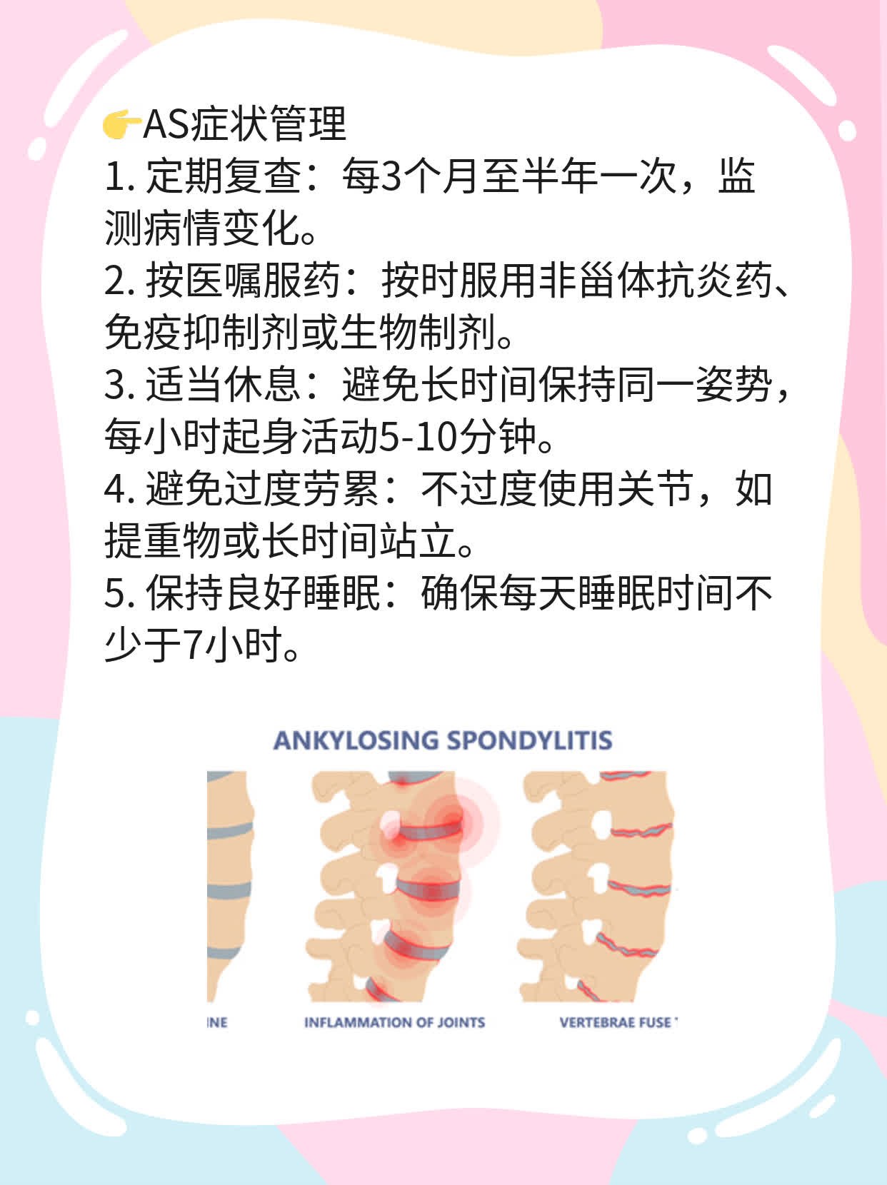 AS患者福音：药物管理是关键！