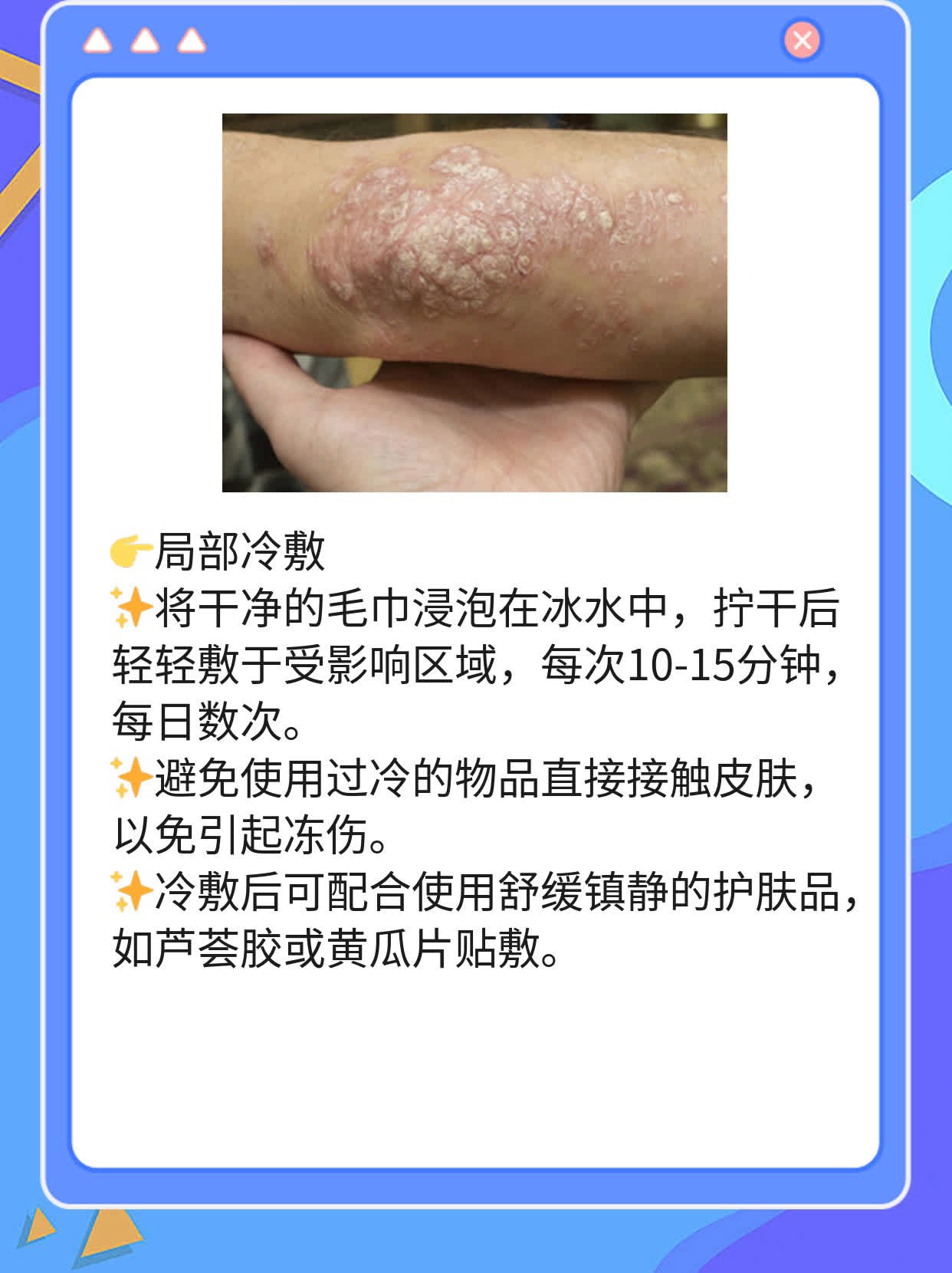 脸上的小疹子又痒？揭秘原因及解决方案！