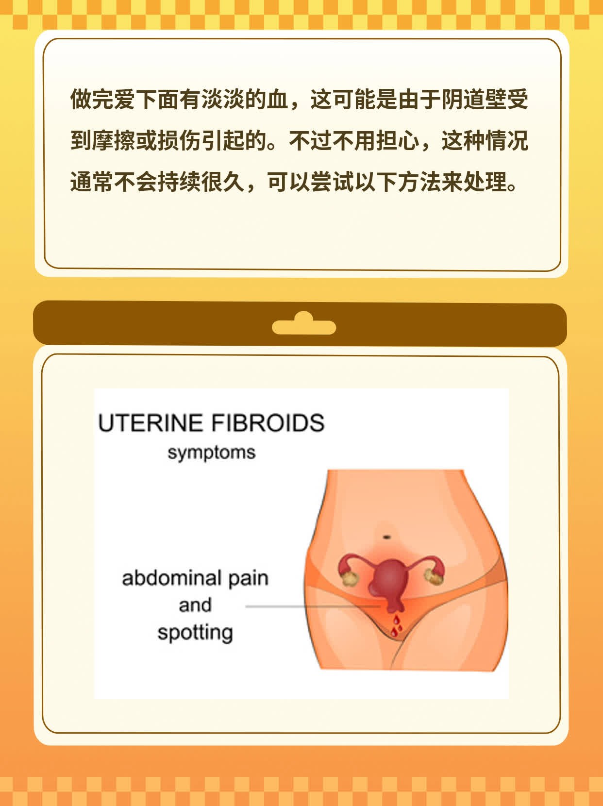 做完爱后阴道出血：初探原因及应对策略