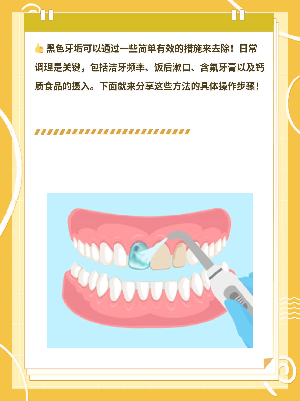 摆脱黑牙垢困扰：简单有效的方法分享！