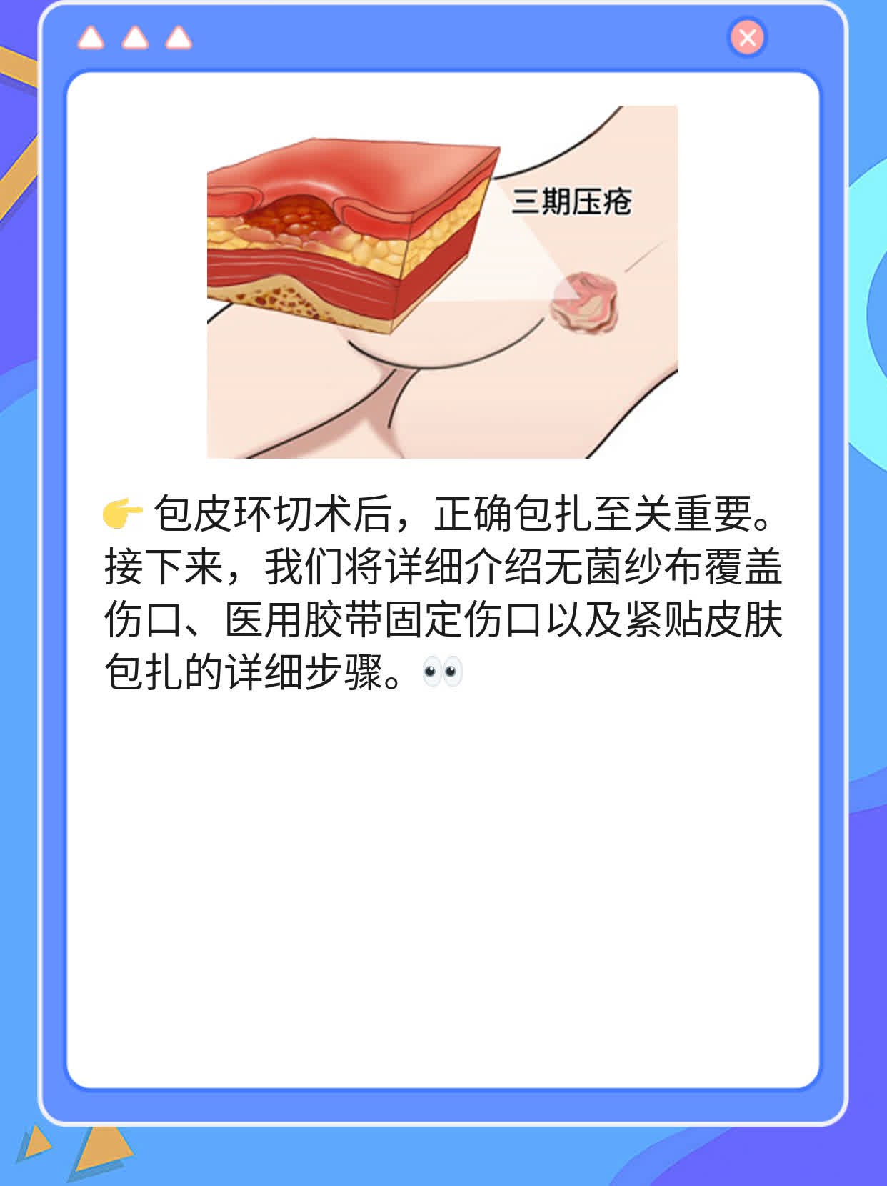 包茎手术包扎胶布图片图片