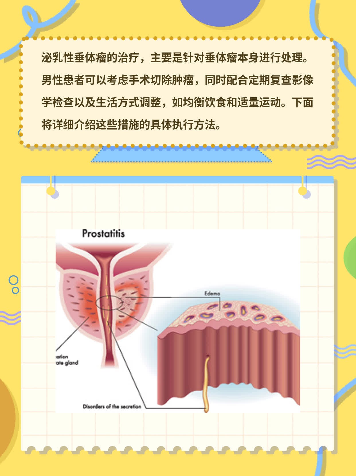 「泌乳性垂体瘤」：男人如何应对？