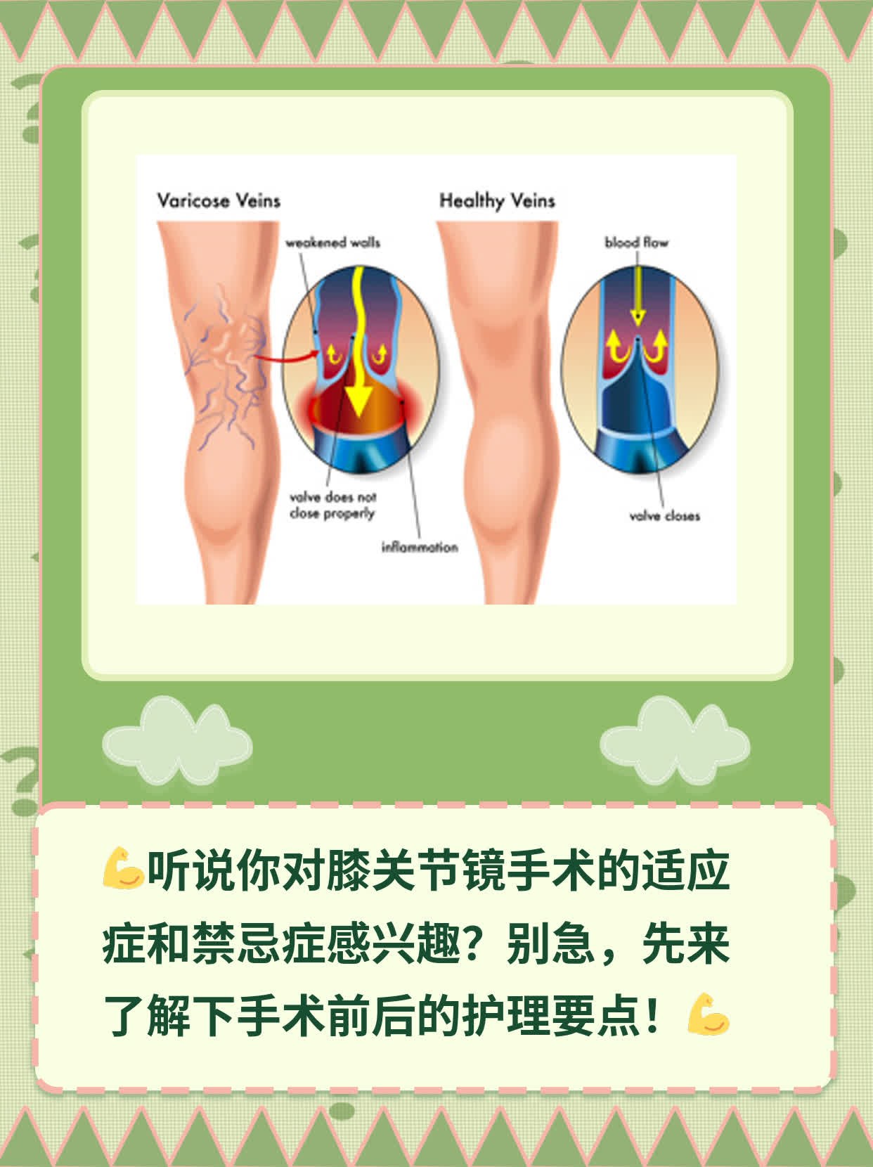 「干货」膝关节镜手术的适应&禁忌：你不可不知！