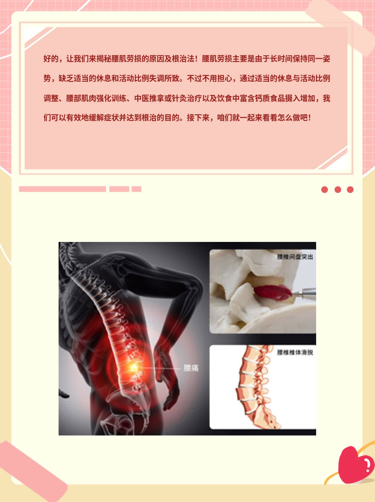 「揭秘」腰肌劳损原因及根治法