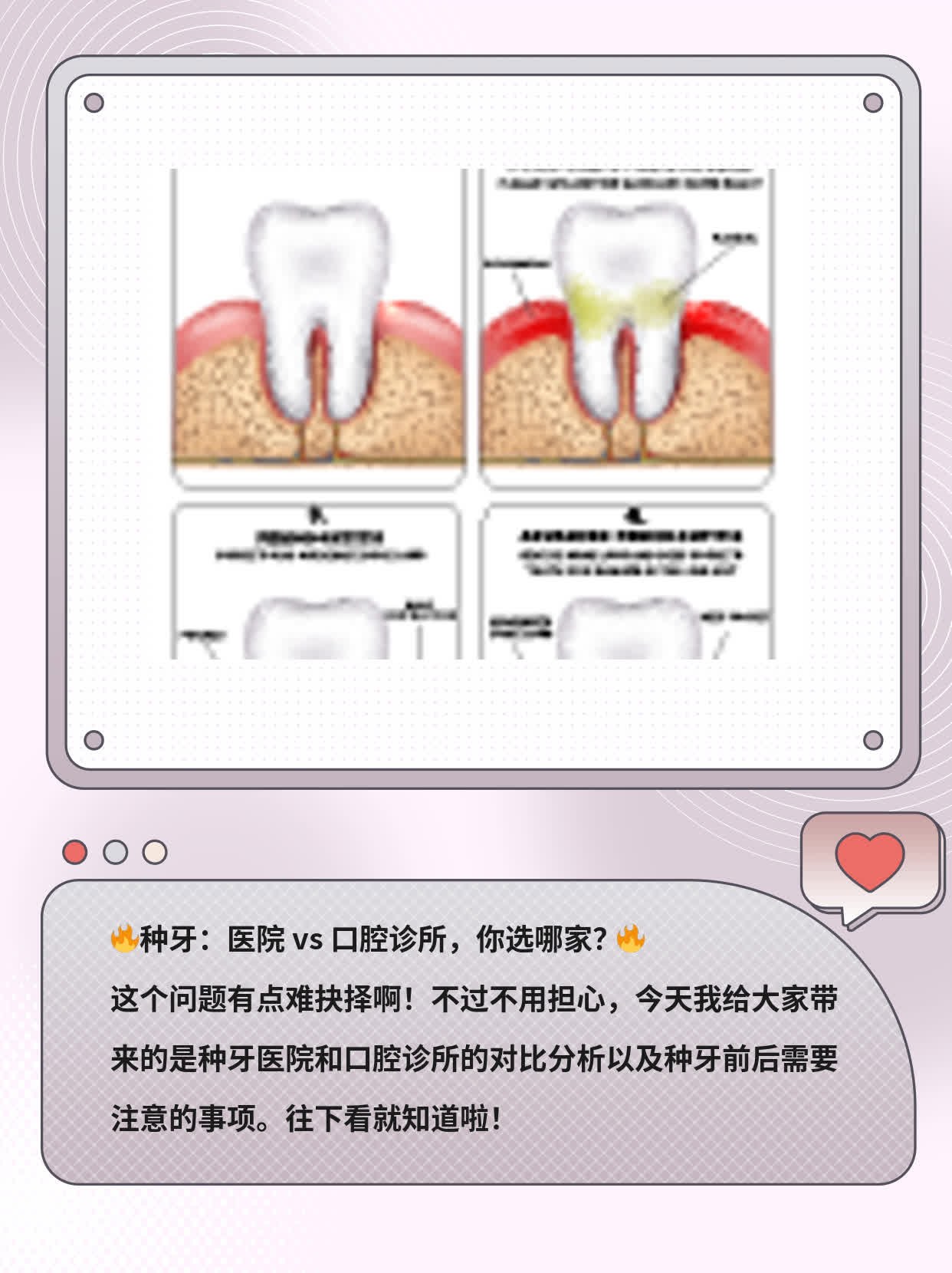 种牙：医院 vs 口腔诊所，你选哪家？
