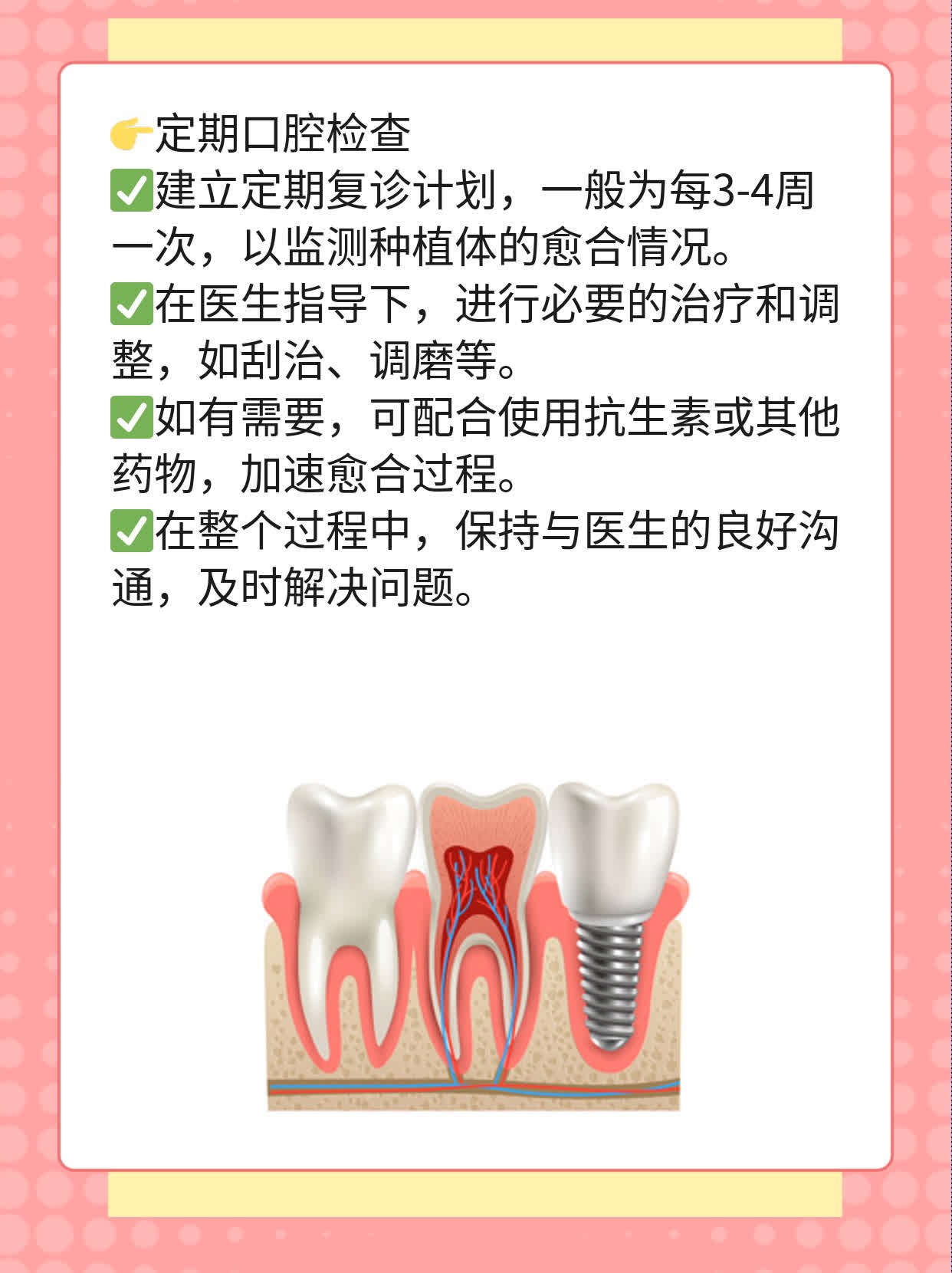 种牙时间揭秘：全程耗时多久？