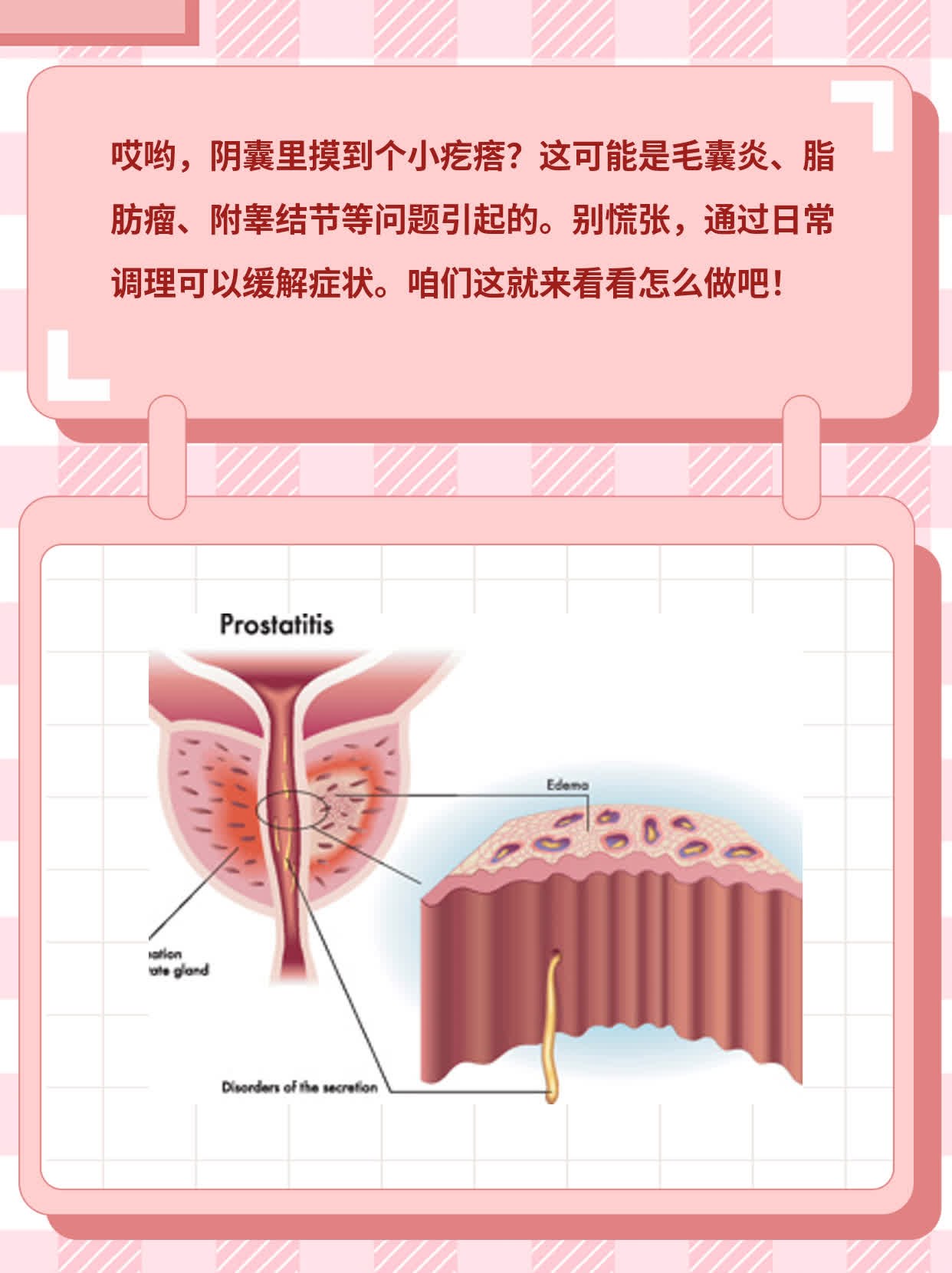 阴部长了小肉芽图片图片