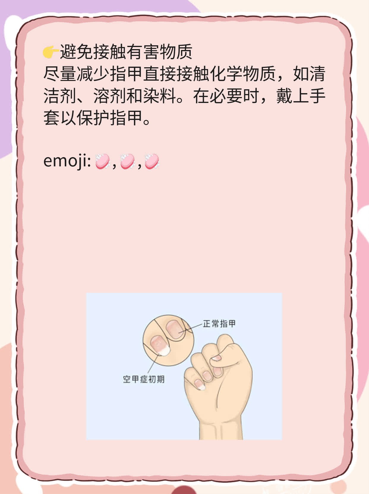 揭秘：指甲上的黑竖纹是怎么回事？