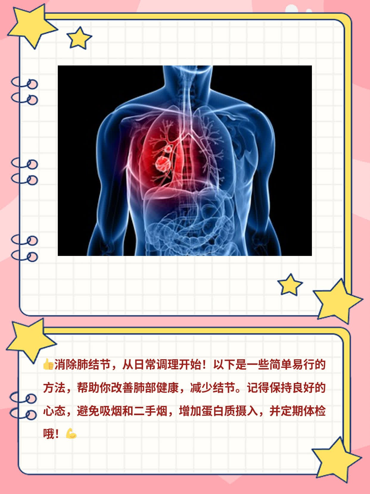 「消除肺结节」妙招：最佳方案大揭秘！