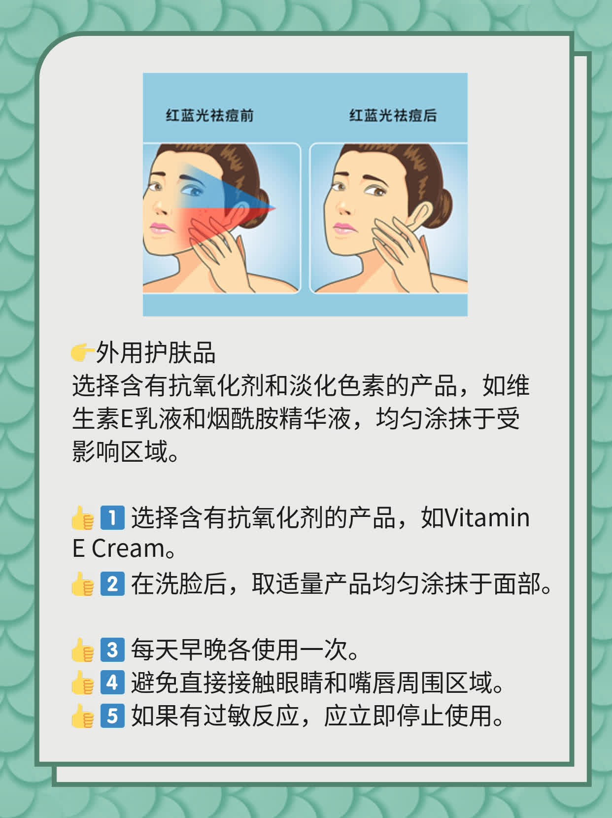 祛除红痘印，揭秘背后原因！