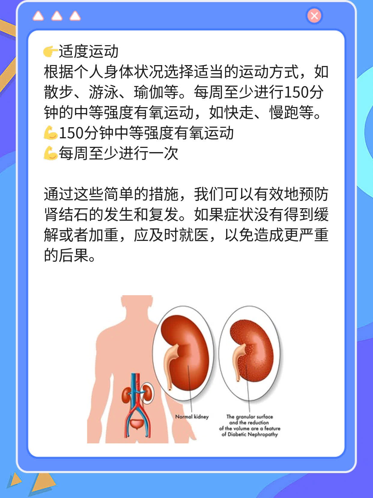 「肾结石」发作，有这4个信号，需警惕！