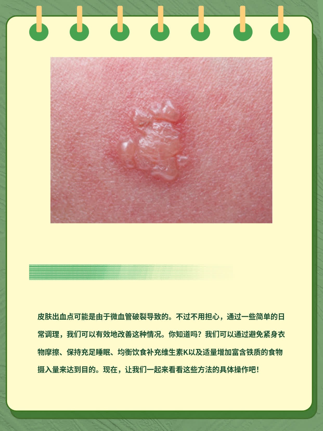 揭秘皮肤出血点诱因：你不可不知的小秘密！