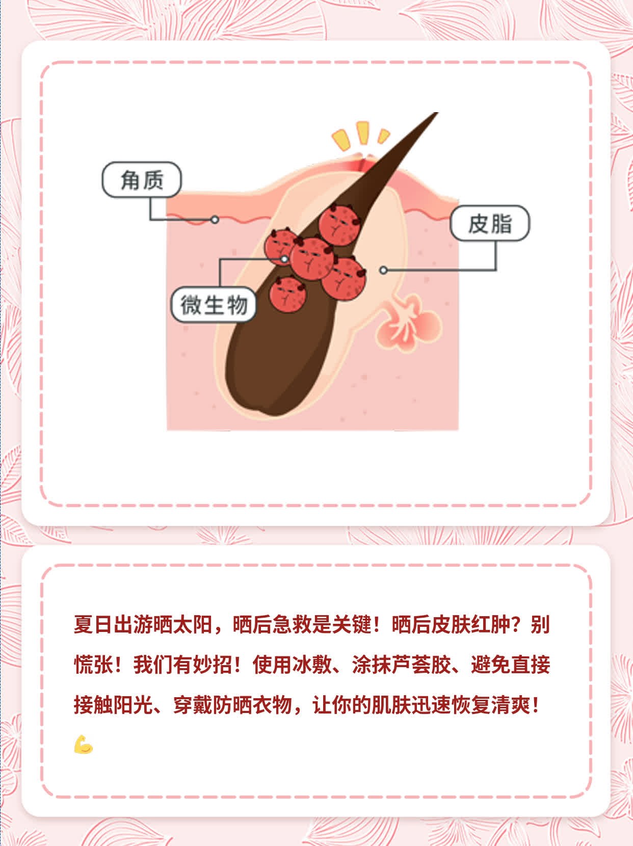 「夏日必备」晒后急救：快速缓解红肿！
