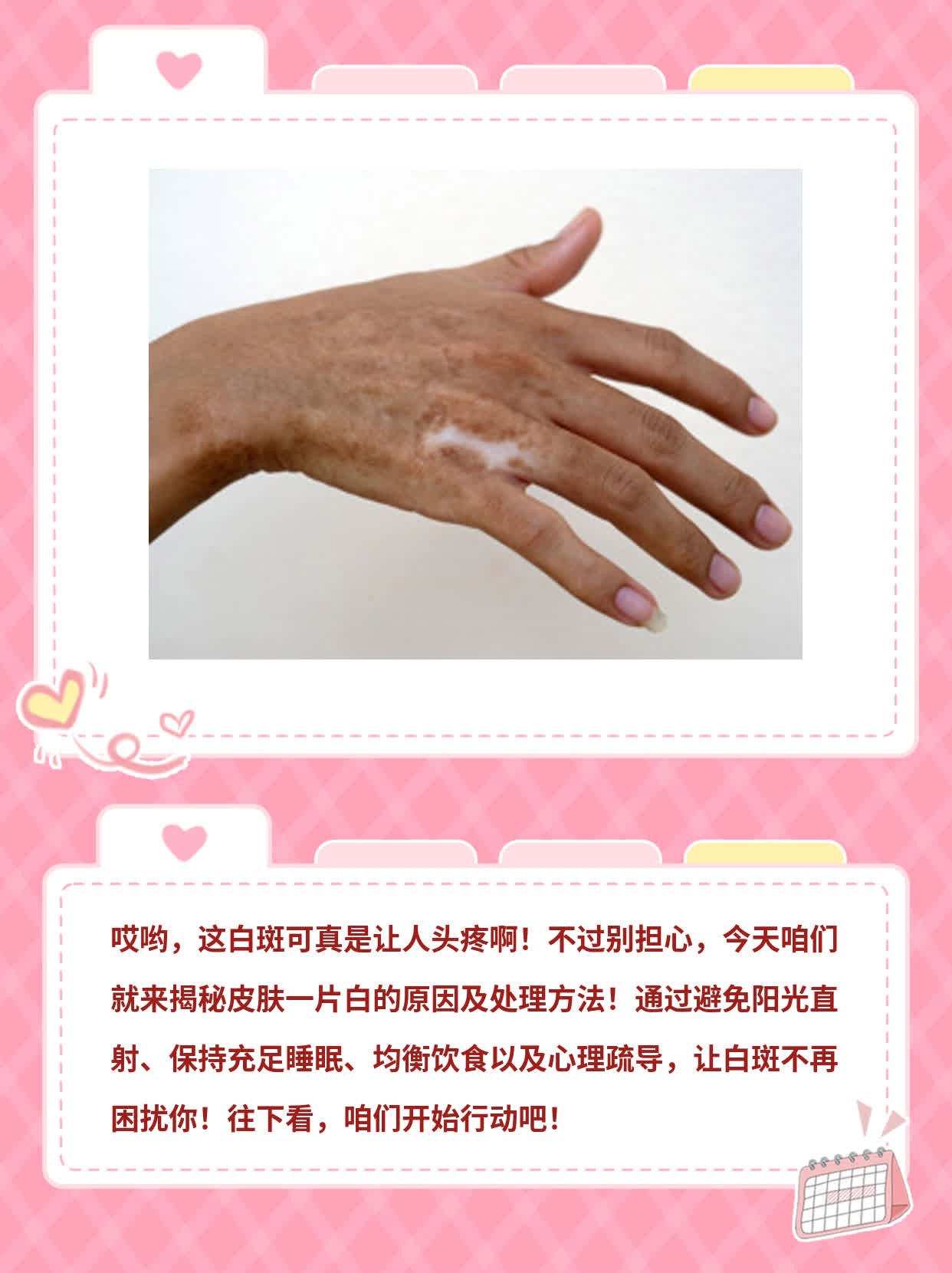 「白斑」：揭秘皮肤一片白的原因及处理方法！