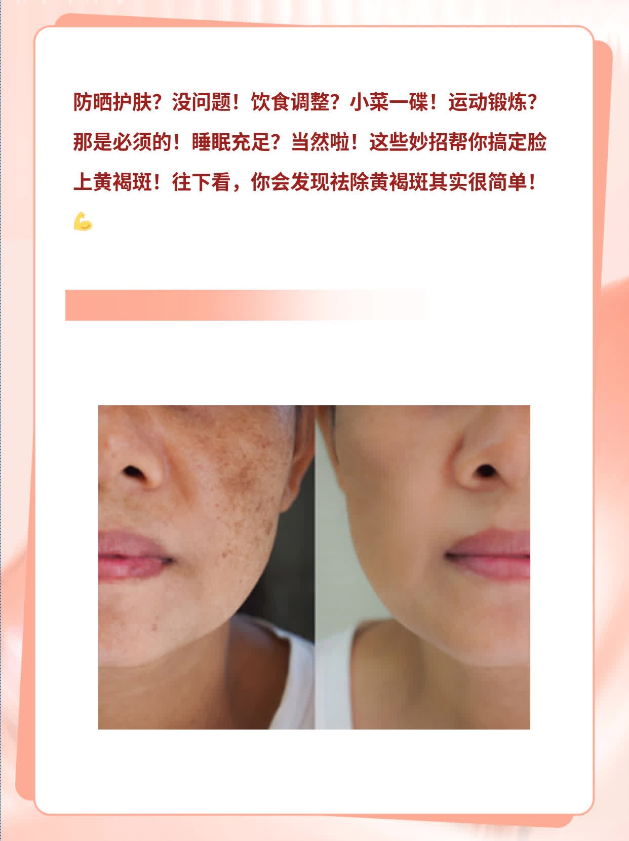 脸上黄褐斑？试试这些妙招！