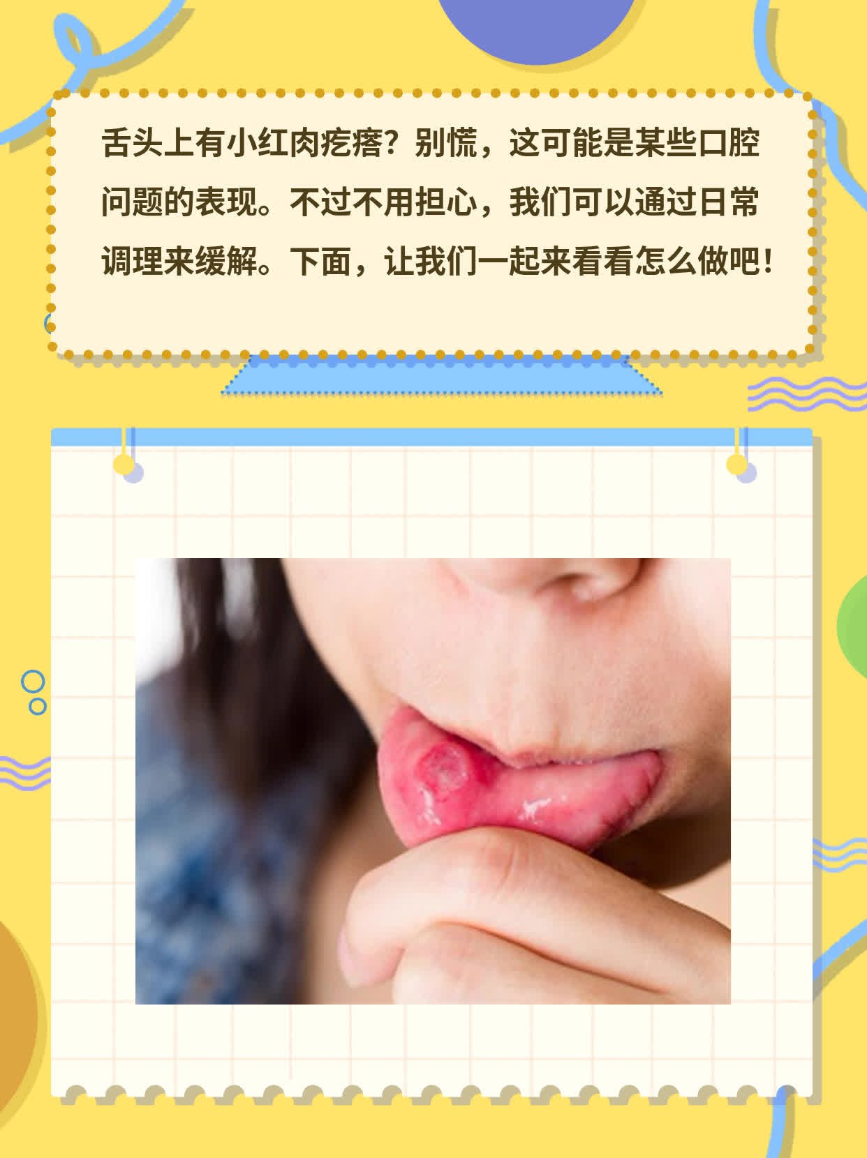 舌头上的小红肉疙瘩？揭秘原因！