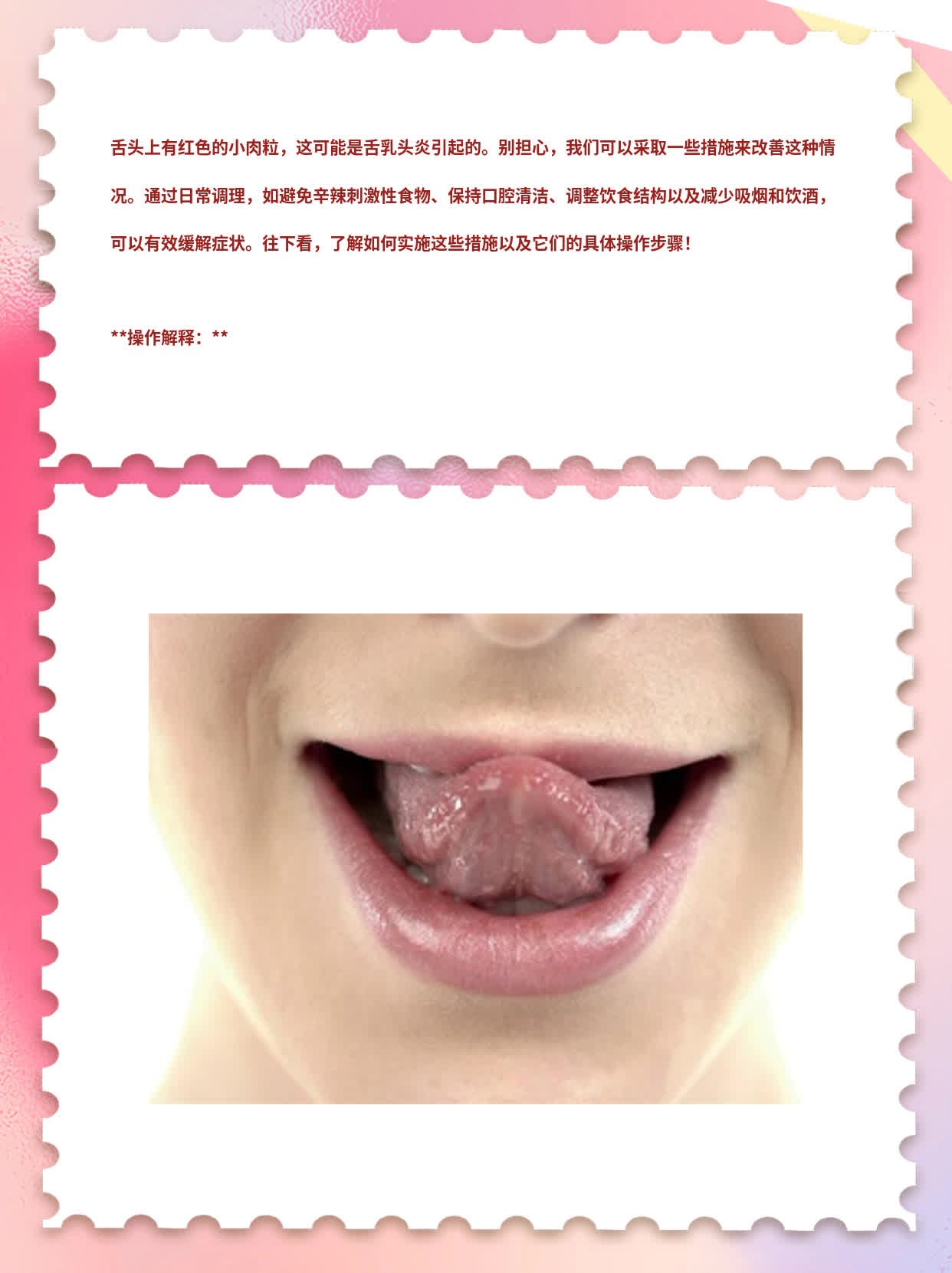 舌头上的小红点？揭秘原因！