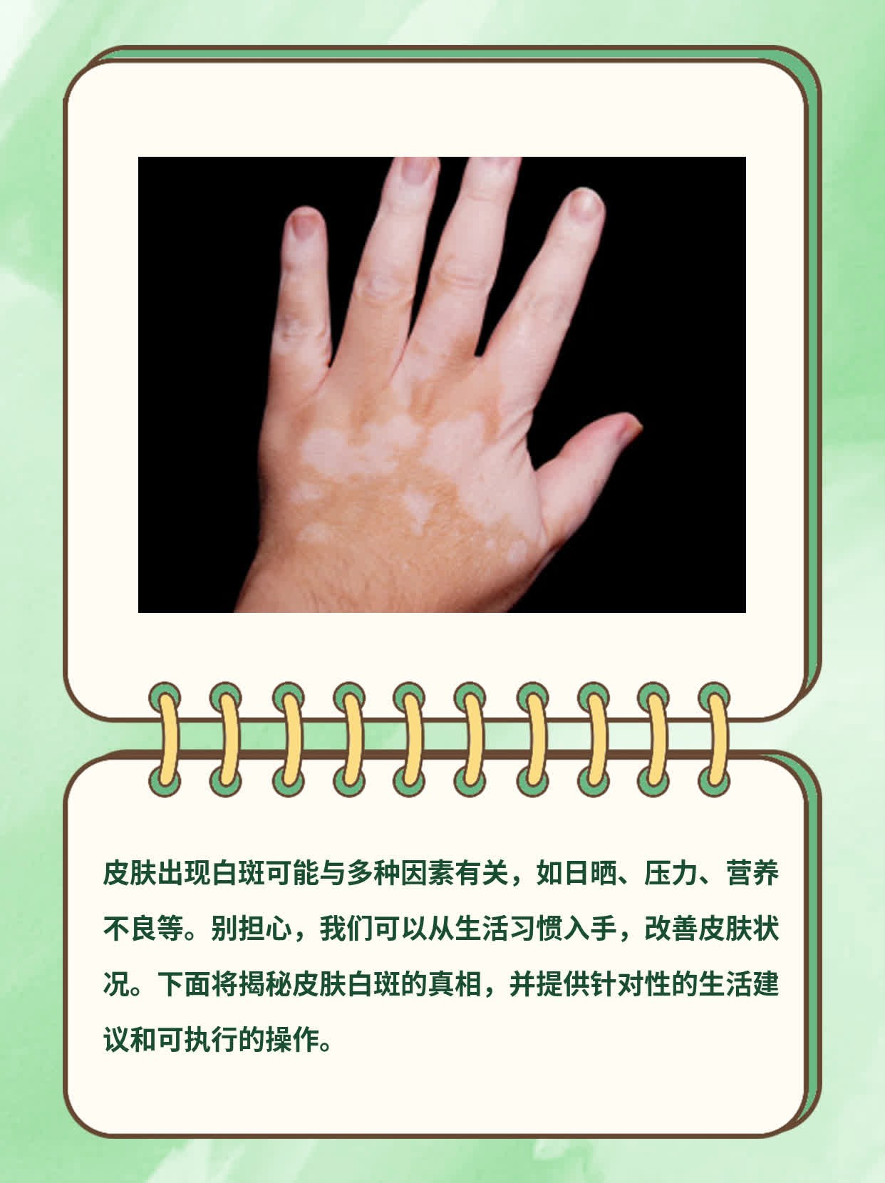 皮肤出白斑？揭秘真相！
