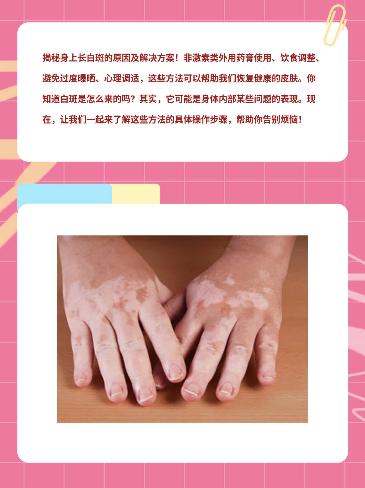 「揭秘」身上长白斑的原因及解决方案