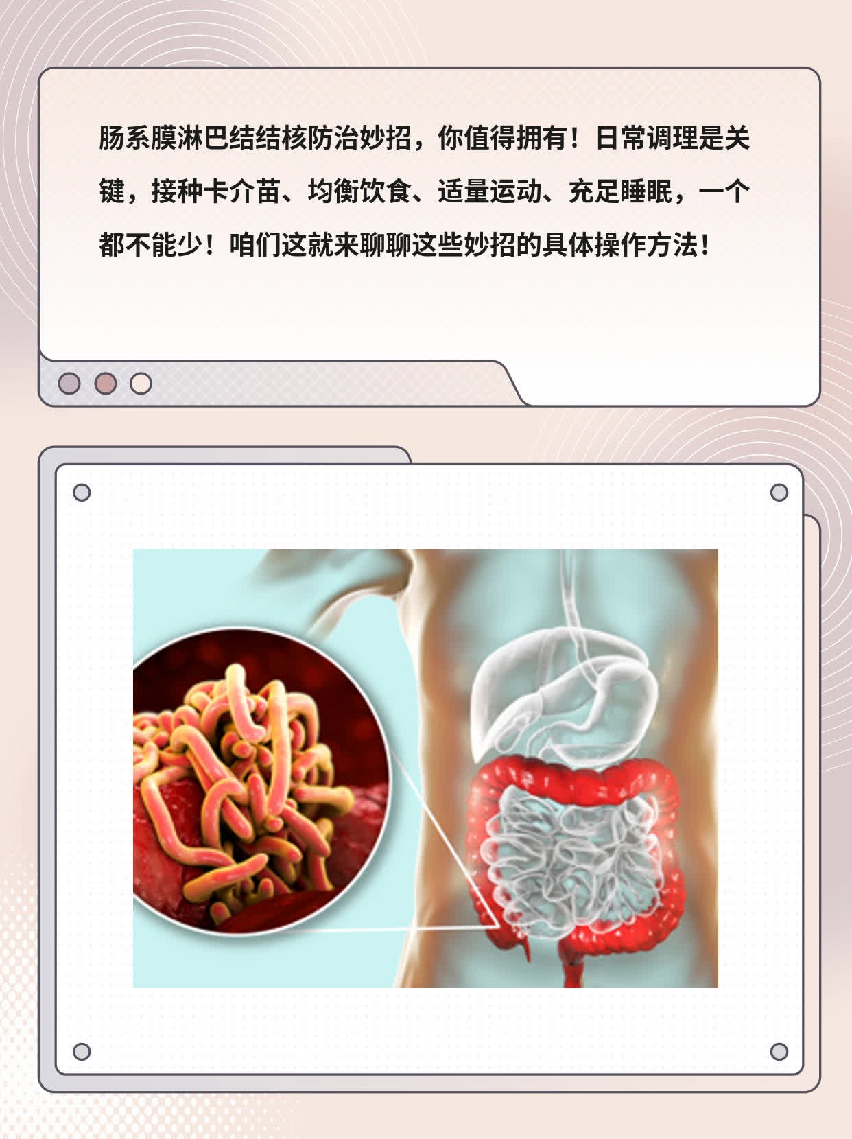 肠系膜淋巴结结核防治妙招