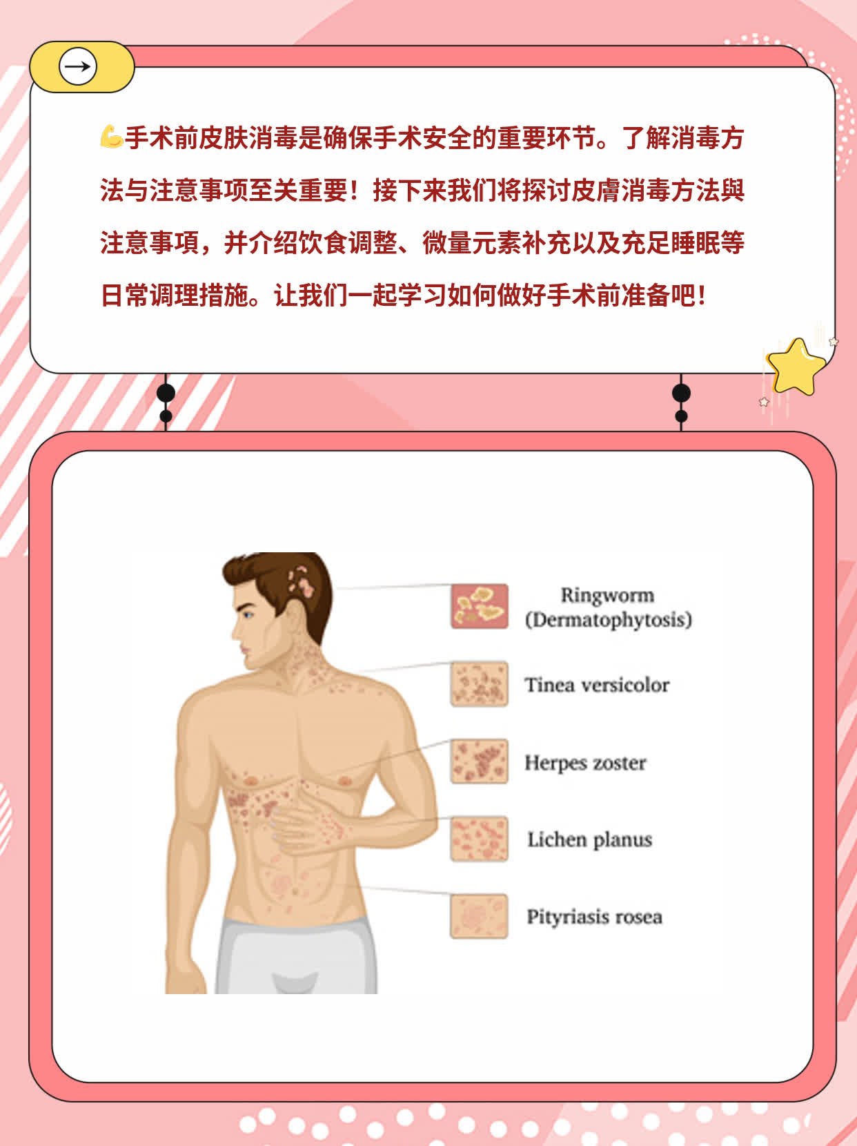 「手術前消毒」：探討皮膚消毒方法與注意事項