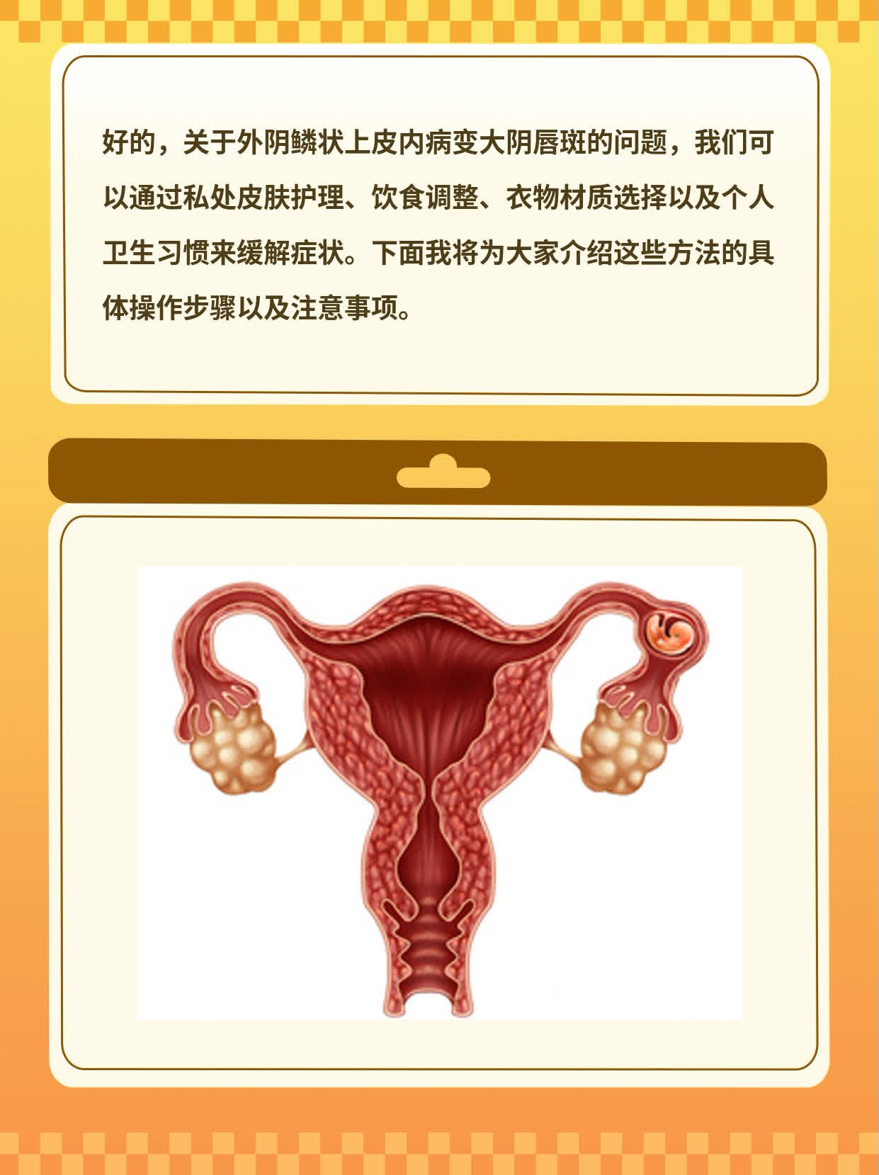 「外阴鳞状上皮内病变」大阴唇斑图解