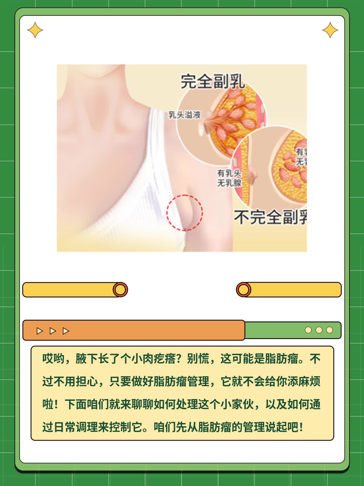 腋下小肉疙瘩？揭秘真相！