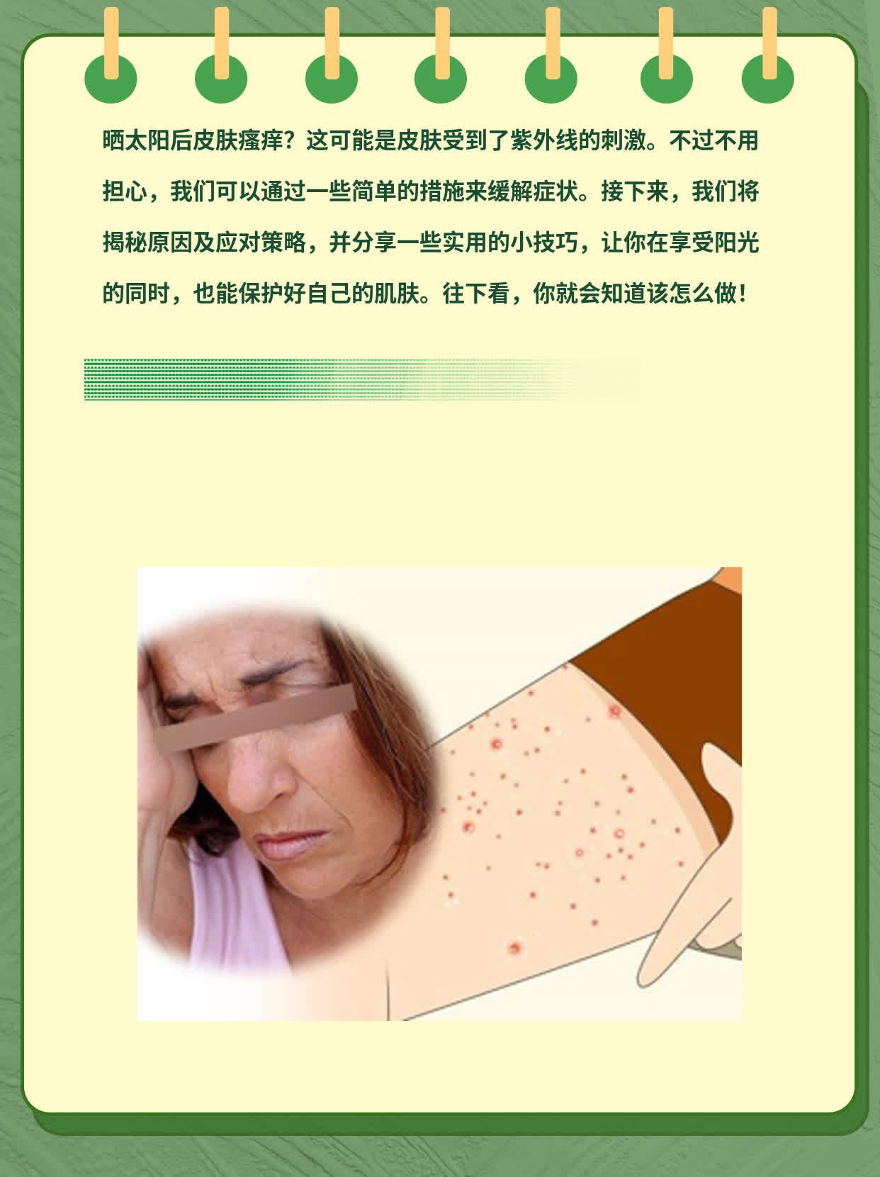 晒太阳后皮肤瘙痒？揭秘原因及应对策略！