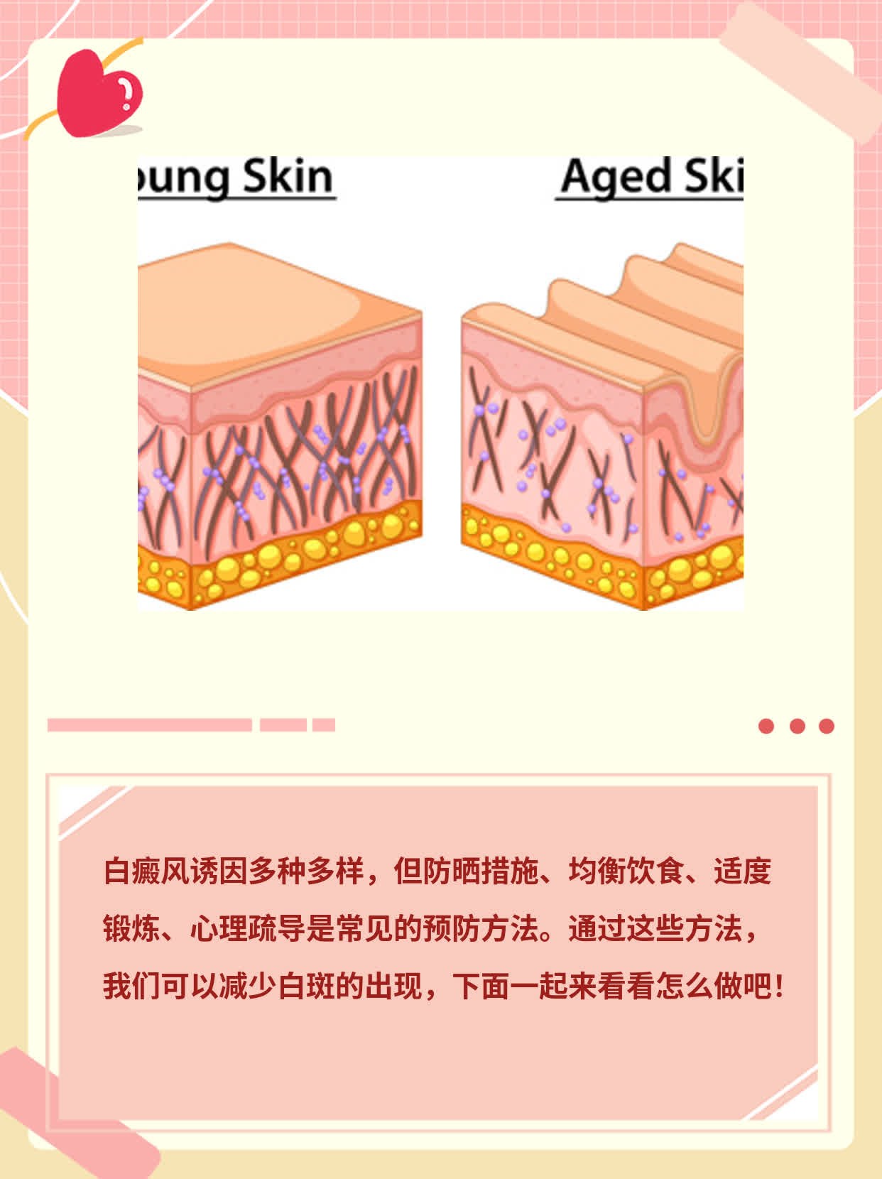 「揭秘」白癜风诱因大盘点！