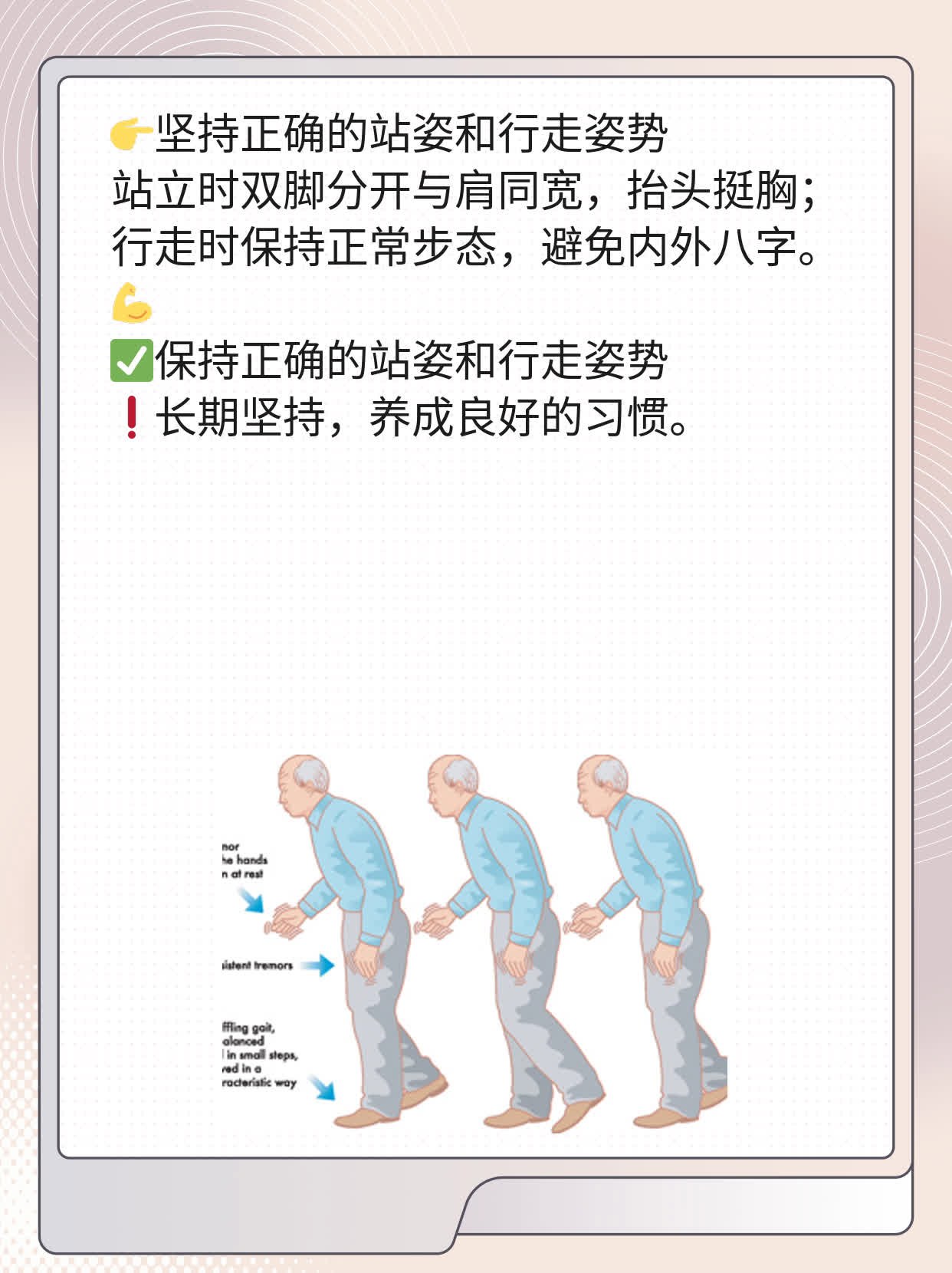 「纠正臀位」：胸膝卧位操作时机不可错过！