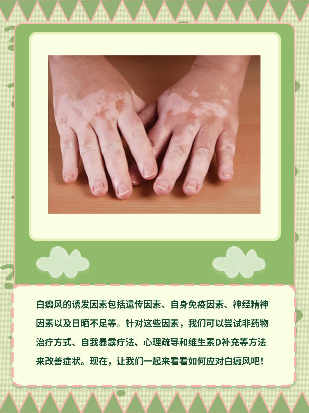 「揭秘」诱发白癜风的因素有哪些？