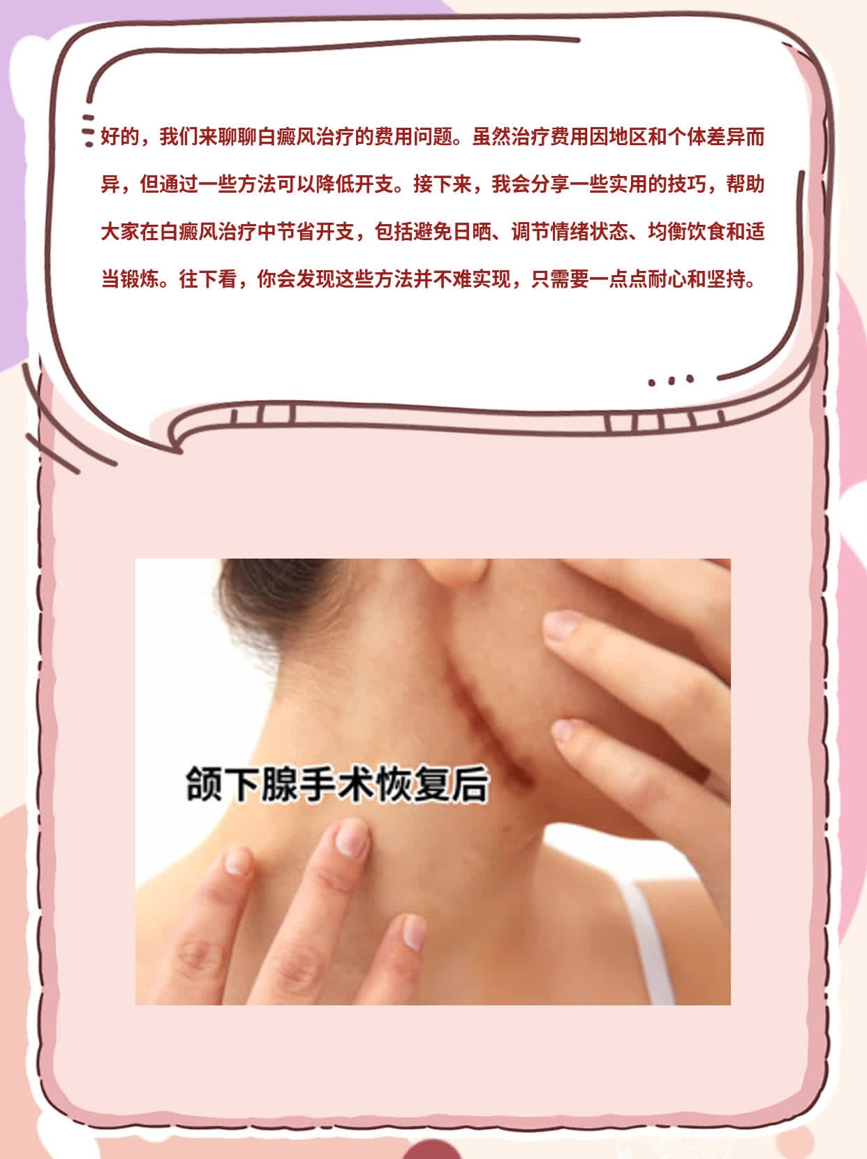 「分享经验」：白癜风治疗费用全揭秘！