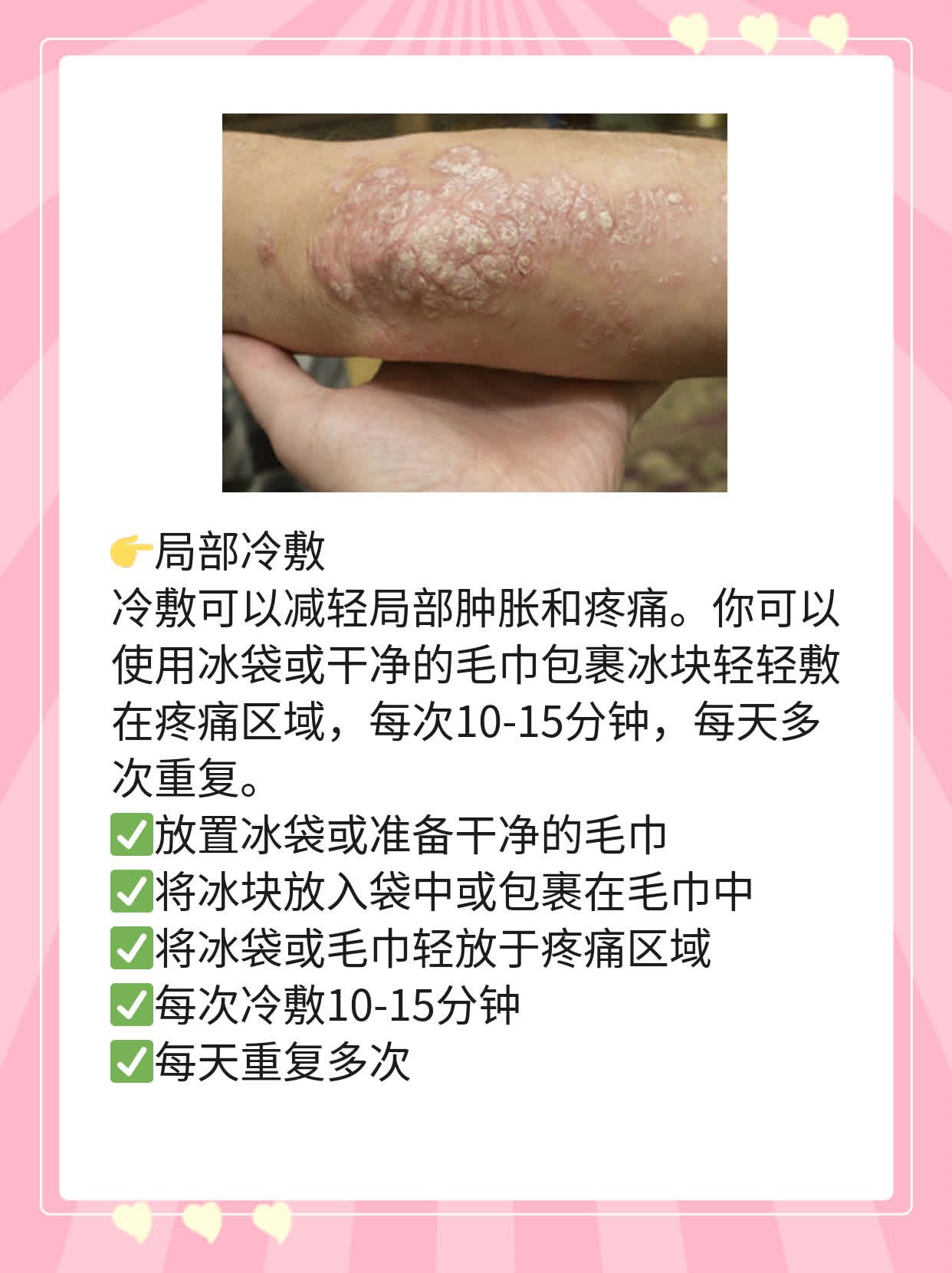 「脖子上有小肉粒还痛」？这可能是……