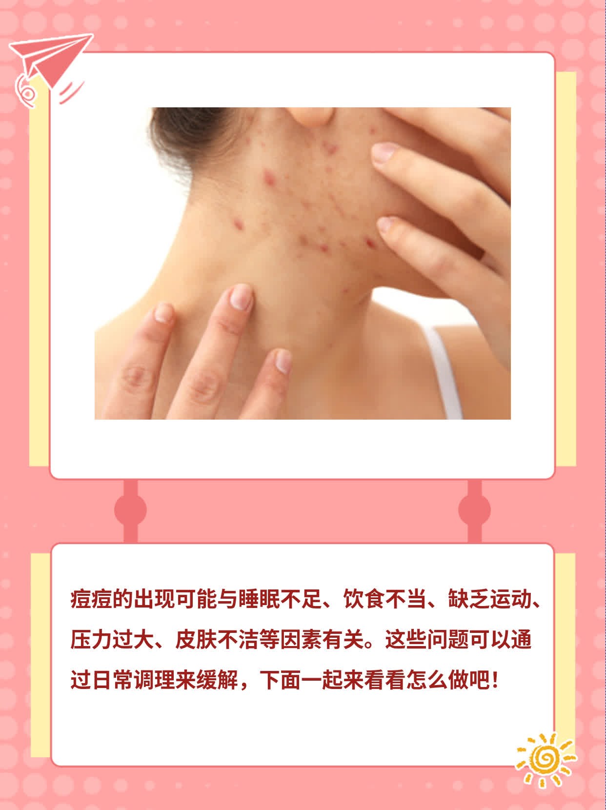 揭秘痘痘背后的故事：探究长痘原因！