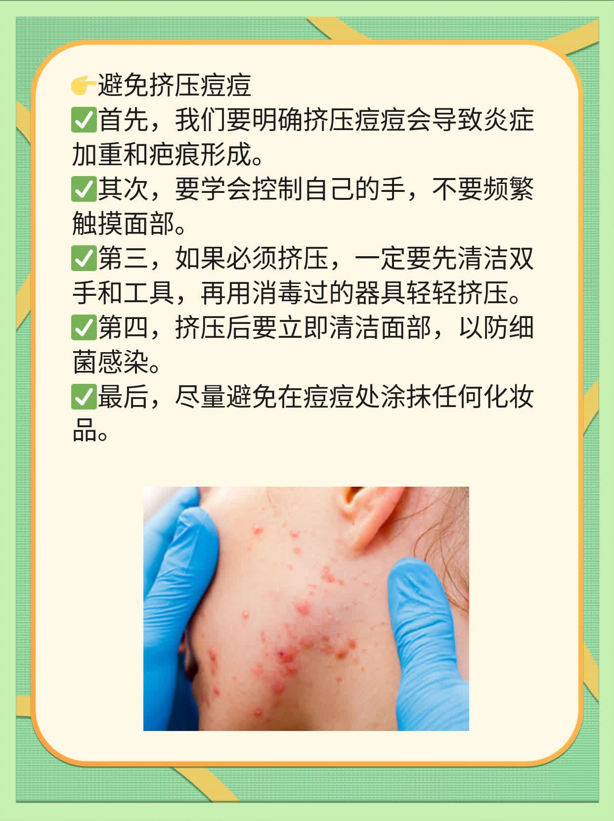 揭秘：痘痘里挤出的白白的东西竟是……！