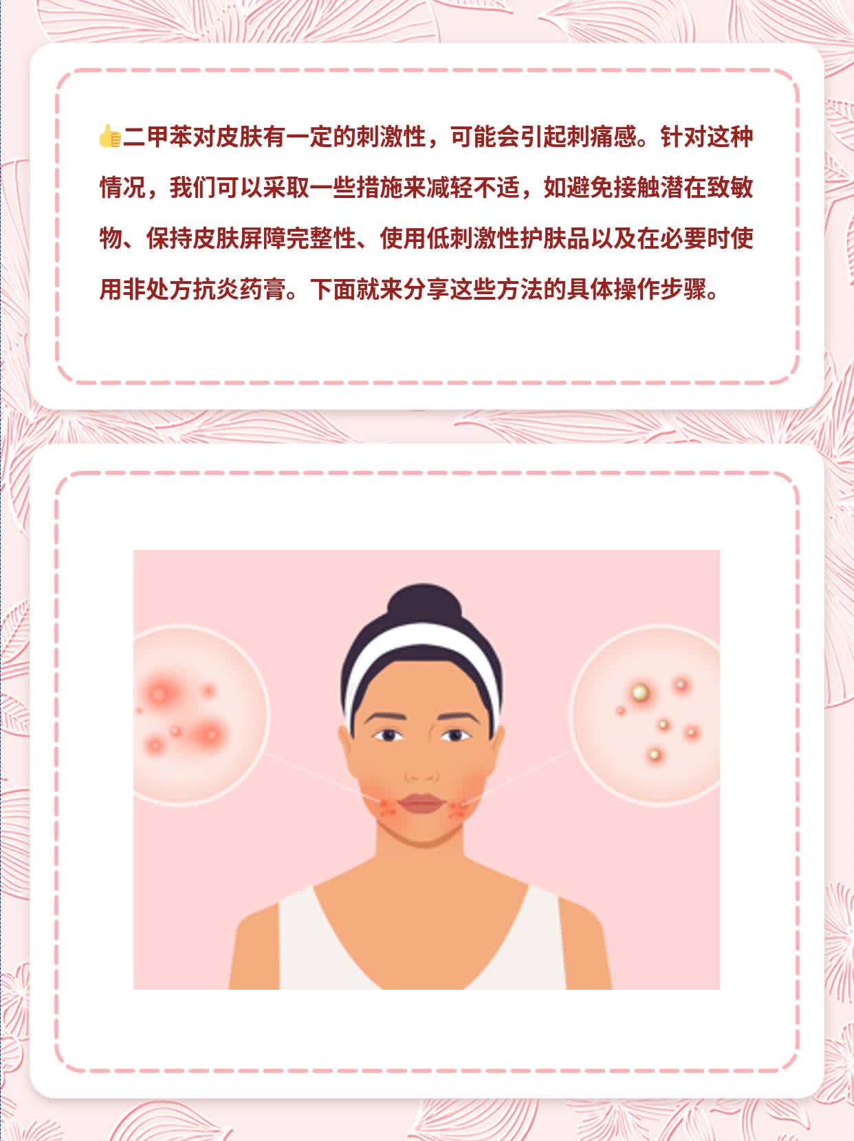 二甲苯对皮肤有无刺痛感？经验分享