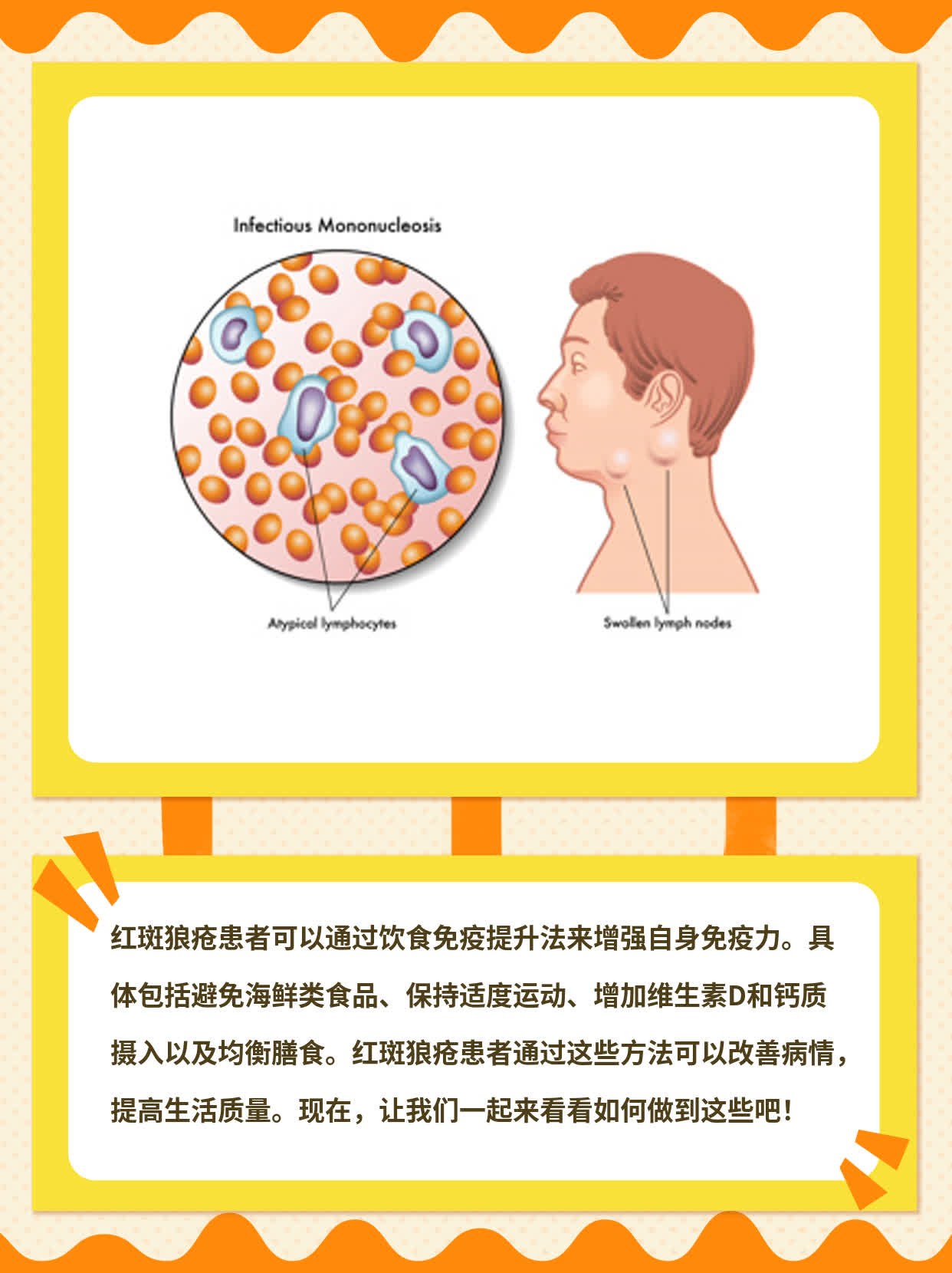 红斑狼疮患者的饮食免疫提升法