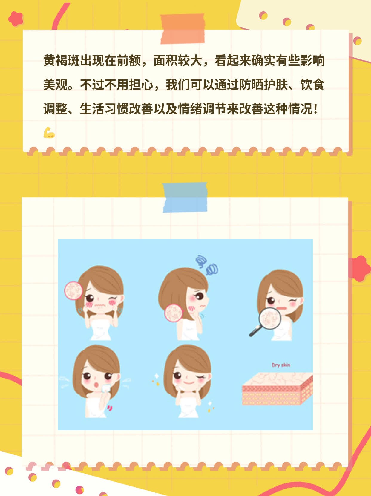 前额黄褐斑一大片，妥了！