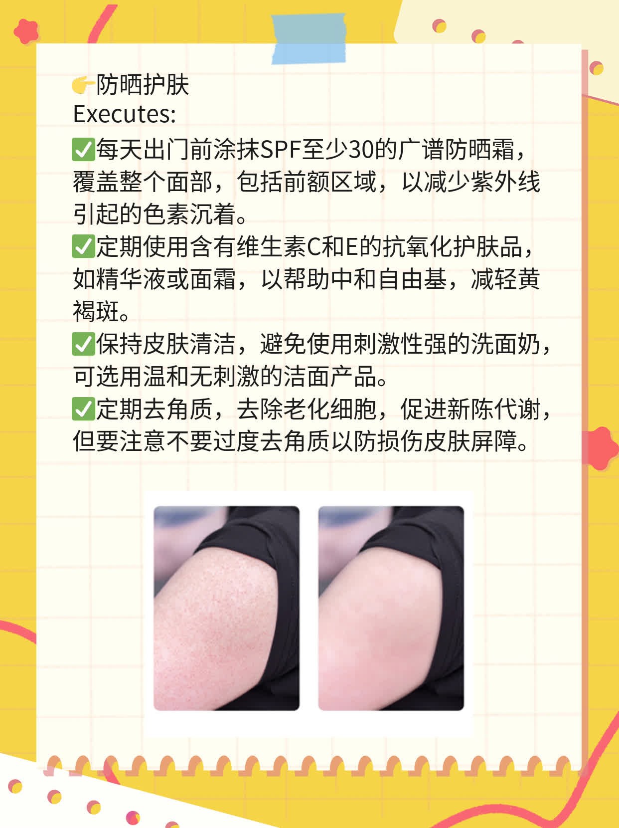 前额黄褐斑一大片，妥了！