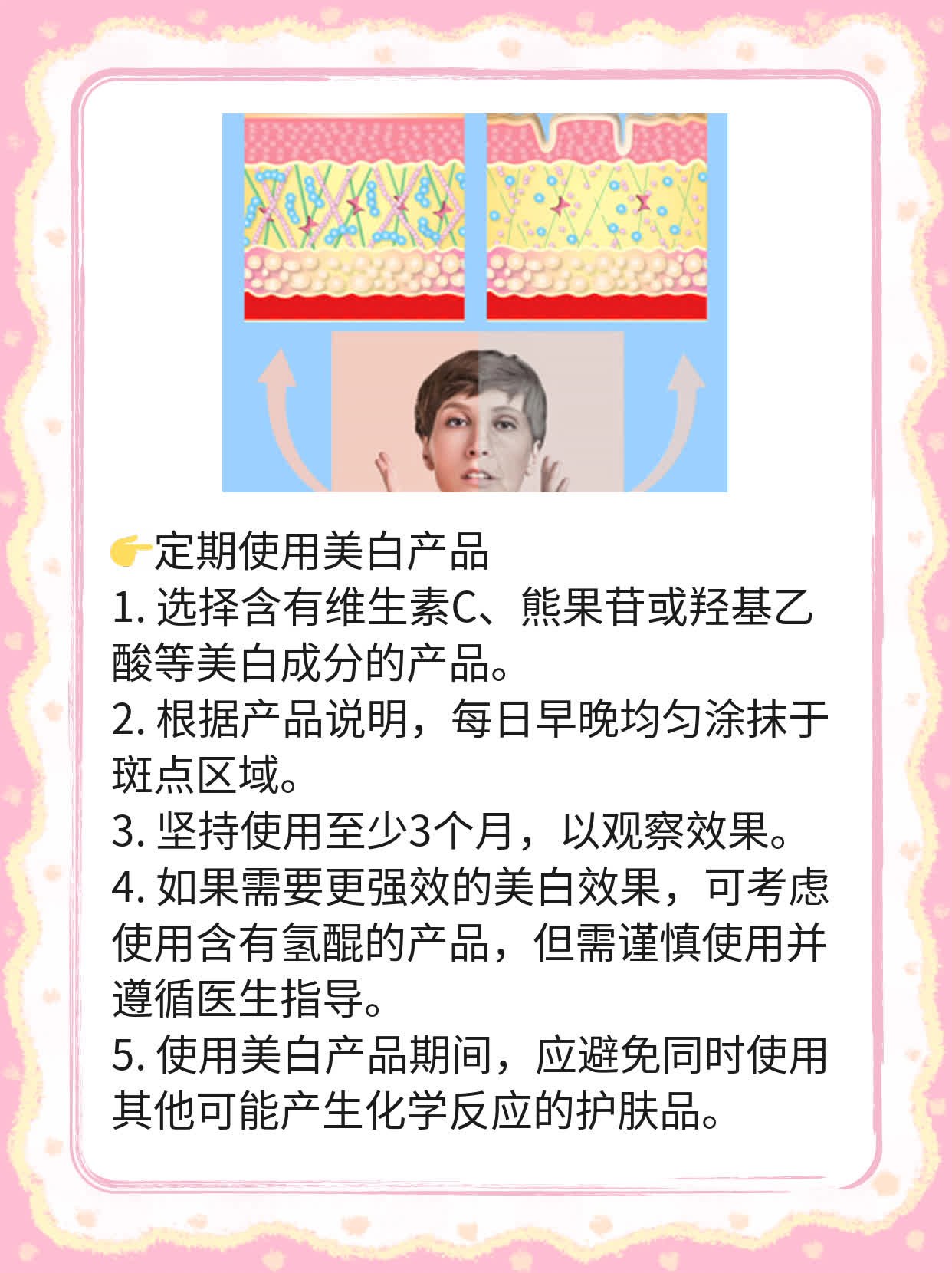 揭秘激光祛斑后的色素沉着现象！