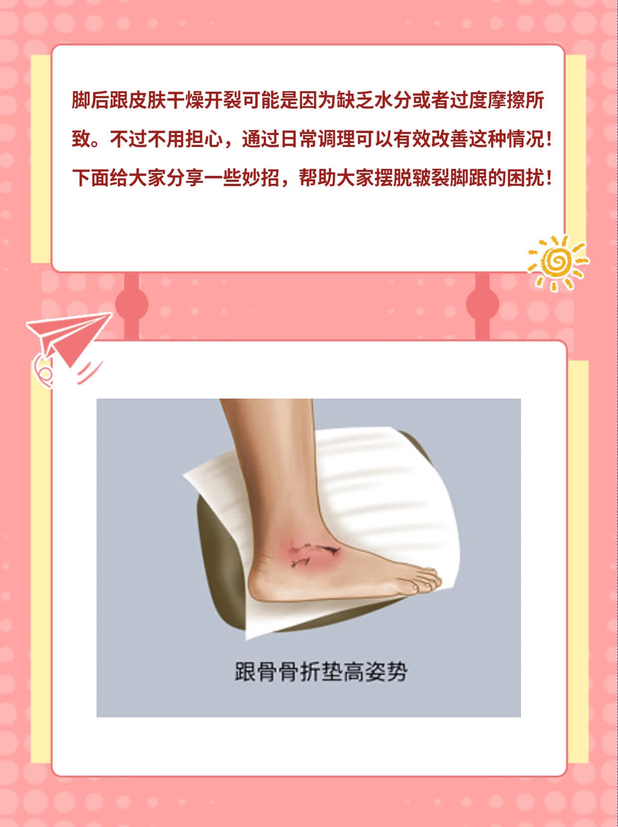 「脚后跟干裂」——拯救皲裂脚跟的妙招！