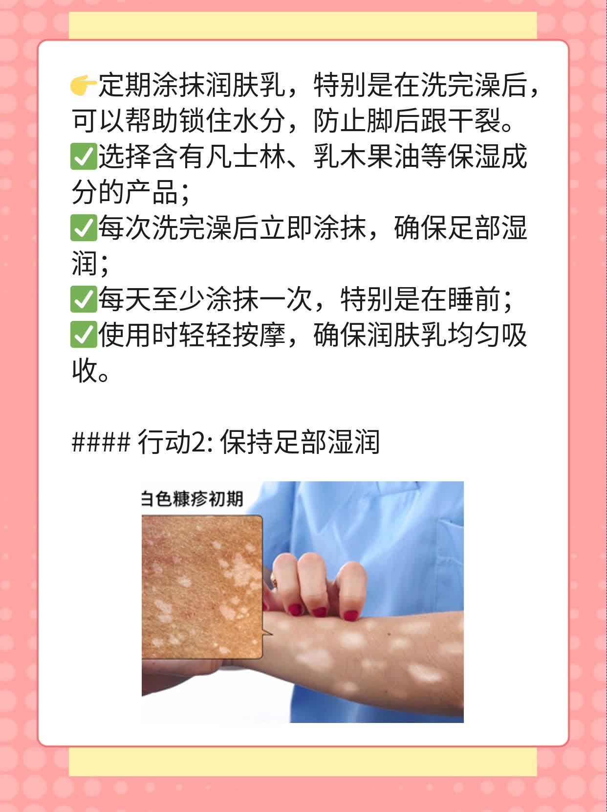 「脚后跟干裂」——拯救皲裂脚跟的妙招！