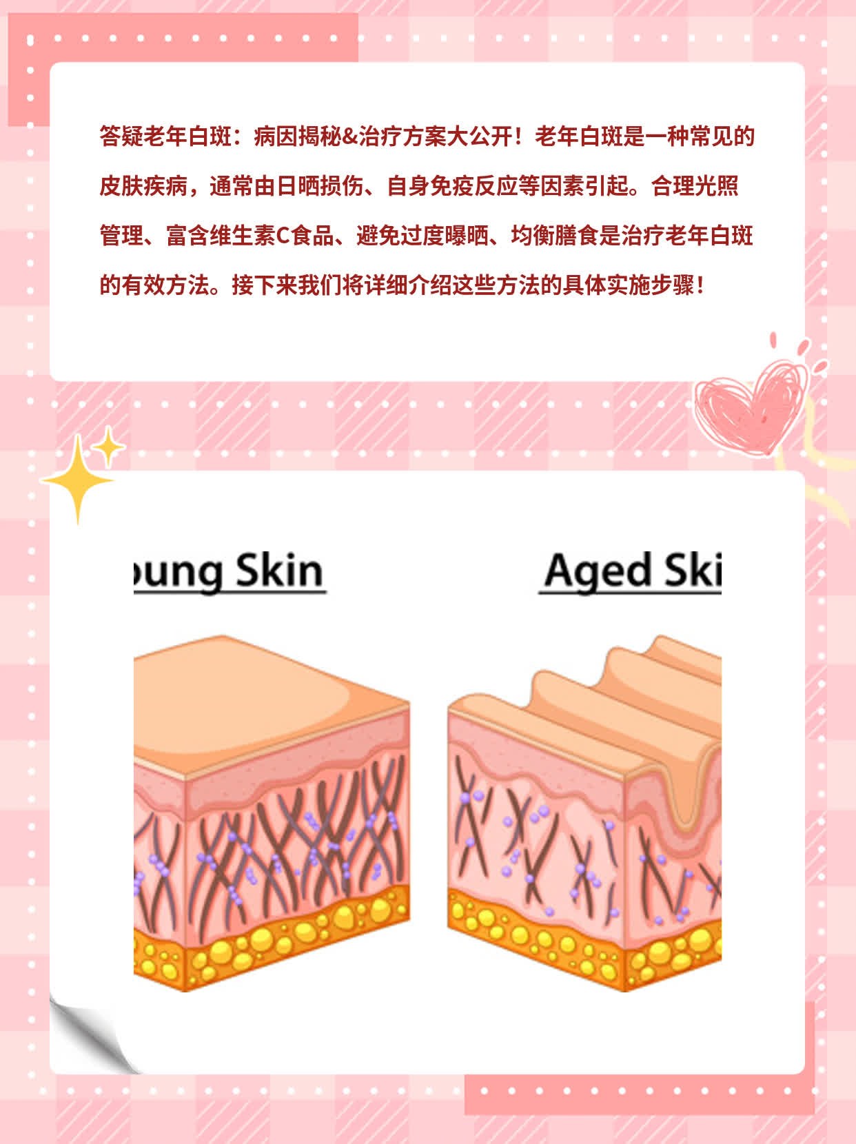 「答疑」老年白斑：病因揭秘&治疗方案大公开！