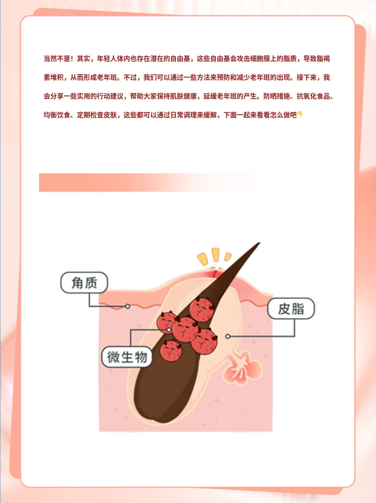 ### 真相：谁说只有老年人才会长老年斑？