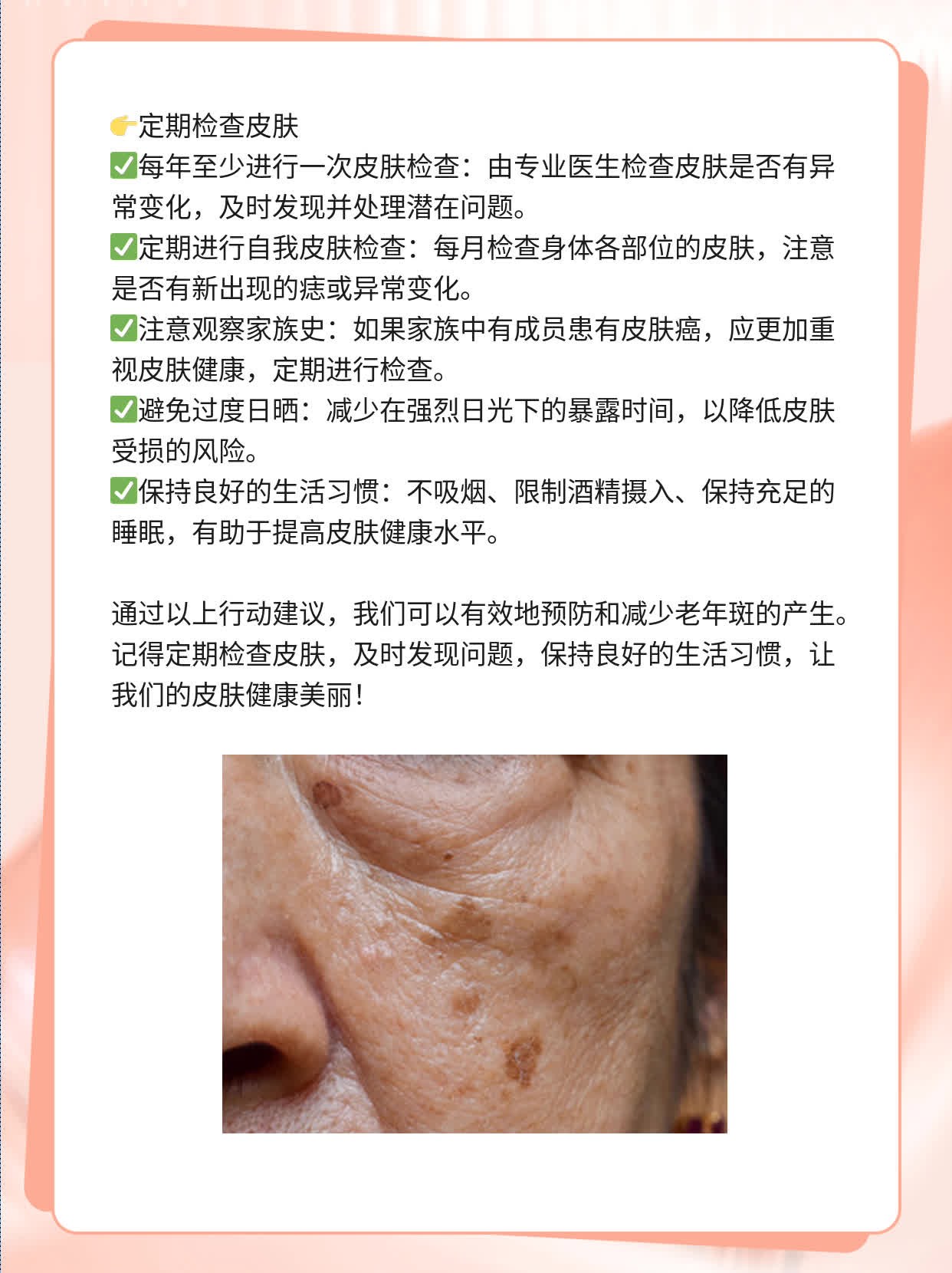 ### 真相：谁说只有老年人才会长老年斑？
