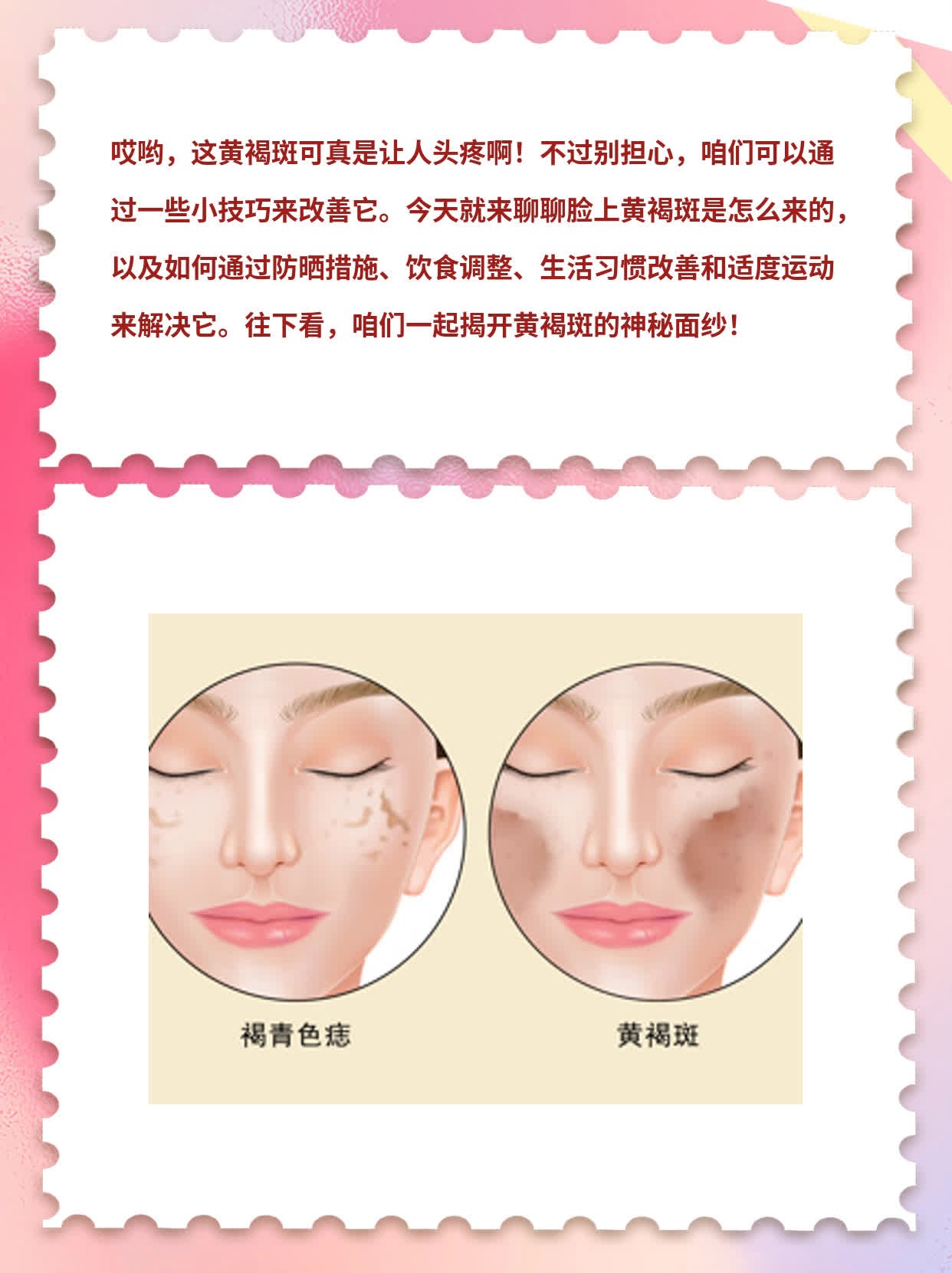 揭秘：脸上的黄褐斑是怎么来的？